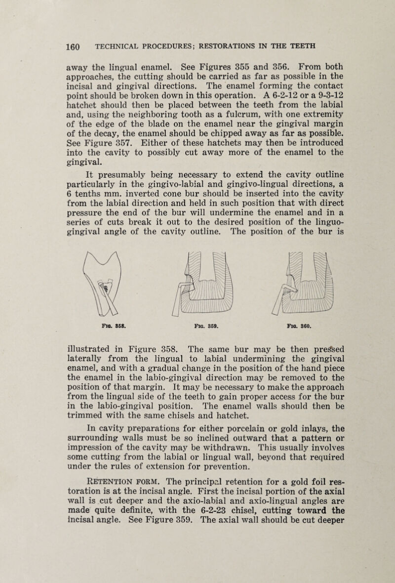 away the lingual enamel. See Figures 355 and 356. From both approaches, the cutting should be carried as far as possible in the incisal and gingival directions. The enamel forming the contact point should be broken down in this operation. A 6-2-12 or a 9-3-12 hatchet should then be placed between the teeth from the labial and, using the neighboring tooth as a fulcrum, with one extremity of the edge of the blade on the enamel near the gingival margin of the decay, the enamel should be chipped away as far as possible. See Figure 357. Either of these hatchets may then be introduced into the cavity to possibly cut away more of the enamel to the gingival. It presumably being necessary to extend the cavity outline particularly in the gingivo-labial and gingivo-lingual directions, a 6 tenths mm. inverted cone bur should be inserted into the cavity from the labial direction and held in such position that with direct pressure the end of the bur will undermine the enamel and in a series of cuts break it out to the desired position of the linguo- gingival angle of the cavity outline. The position of the bur is Fio. 858. Fig. 359. Fio. 360. illustrated in Figure 358. The same bur may be then pressed laterally from the lingual to labial undermining the gingival enamel, and with a gradual change in the position of the hand piece the enamel in the labio-gingival direction may be removed to the position of that margin. It may be necessary to make the approach from the lingual side of the teeth to gain proper access for the bur in the labio-gingival position. The enamel walls should then be trimmed with the same chisels and hatchet. In cavity preparations for either porcelain or gold inlays, the surrounding walls must be so inclined outward that a pattern or impression of the cavity may be withdrawn. This usually involves some cutting from the labial or lingual wall, beyond that required under the rules of extension for prevention. Retention form. The principal retention for a gold foil res¬ toration is at the incisal angle. First the incisal portion of the axial wall is cut deeper and the axio-labial and axio-lingual angles are made quite definite, with the 6-2-23 chisel, cutting toward the incisal angle. See Figure 359. The axial wall should be cut deeper