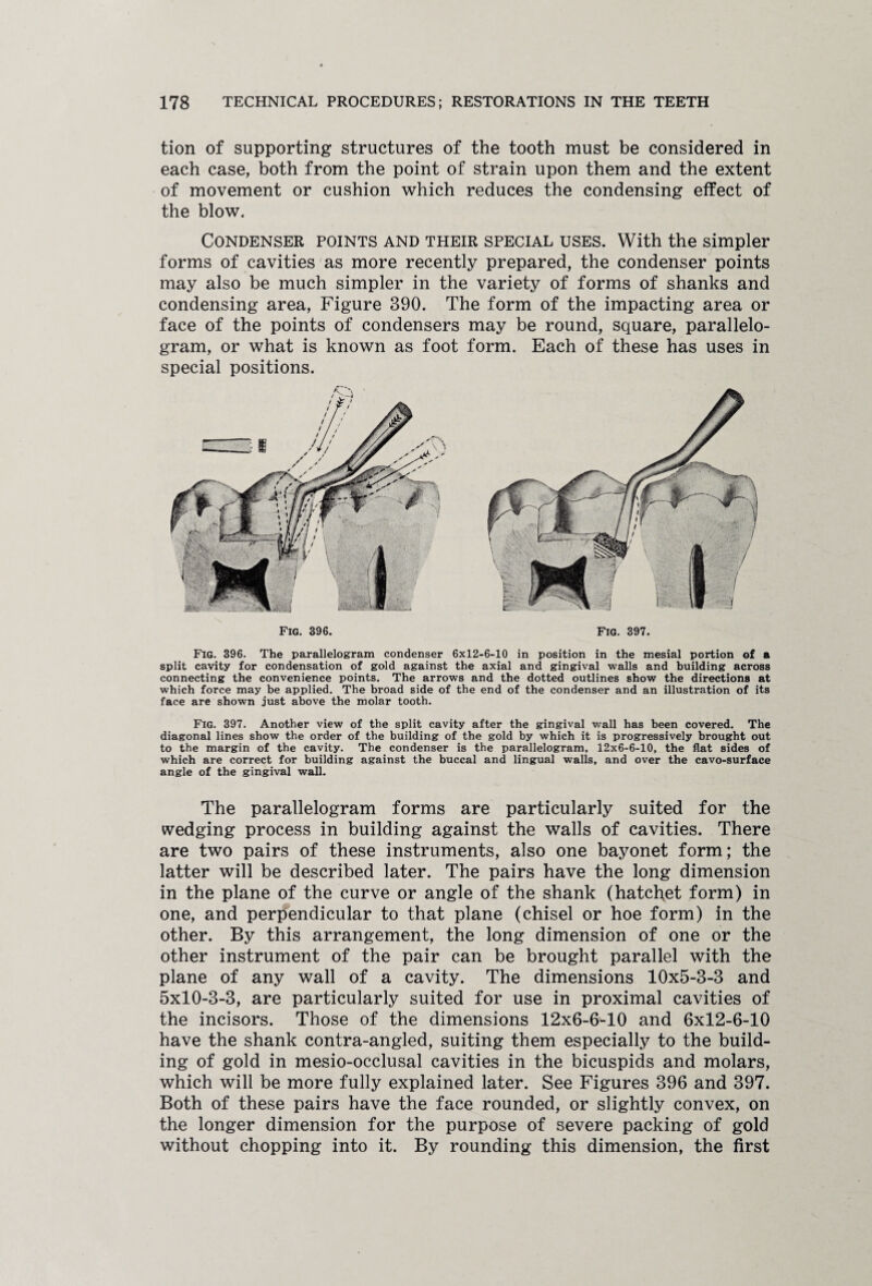 tion of supporting structures of the tooth must be considered in each case, both from the point of strain upon them and the extent of movement or cushion which reduces the condensing effect of the blow. Condenser points and their special uses. With the simpler forms of cavities as more recently prepared, the condenser points may also be much simpler in the variety of forms of shanks and condensing area, Figure 390. The form of the impacting area or face of the points of condensers may be round, square, parallelo¬ gram, or what is known as foot form. Each of these has uses in special positions. Fig. 396. Fig. 397. Fig. 396. The parallelogram condenser 6x12-6-10 in position in the mesial portion of a split cavity for condensation of gold against the axial and gingival walls and building across connecting the convenience points. The arrows and the dotted outlines show the directions at which force may be applied. The broad side of the end of the condenser and an illustration of its face are shown just above the molar tooth. Fig. 397. Another view of the split cavity after the gingival wall has been covered. The diagonal lines show the order of the building of the gold by which it is progressively brought out to the margin of the cavity. The condenser is the parallelogram, 12x6-6-10, the flat sides of which are correct for building against the buccal and lingual walls, and over the cavo-surface angle of the gingival wall. The parallelogram forms are particularly suited for the wedging process in building against the walls of cavities. There are two pairs of these instruments, also one bayonet form; the latter will be described later. The pairs have the long dimension in the plane of the curve or angle of the shank (hatchet form) in one, and perpendicular to that plane (chisel or hoe form) in the other. By this arrangement, the long dimension of one or the other instrument of the pair can be brought parallel with the plane of any wall of a cavity. The dimensions 10x5-3-3 and 5x10-3-3, are particularly suited for use in proximal cavities of the incisors. Those of the dimensions 12x6-6-10 and 6x12-6-10 have the shank contra-angled, suiting them especially to the build¬ ing of gold in mesio-occlusal cavities in the bicuspids and molars, which will be more fully explained later. See Figures 396 and 397. Both of these pairs have the face rounded, or slightly convex, on the longer dimension for the purpose of severe packing of gold without chopping into it. By rounding this dimension, the first