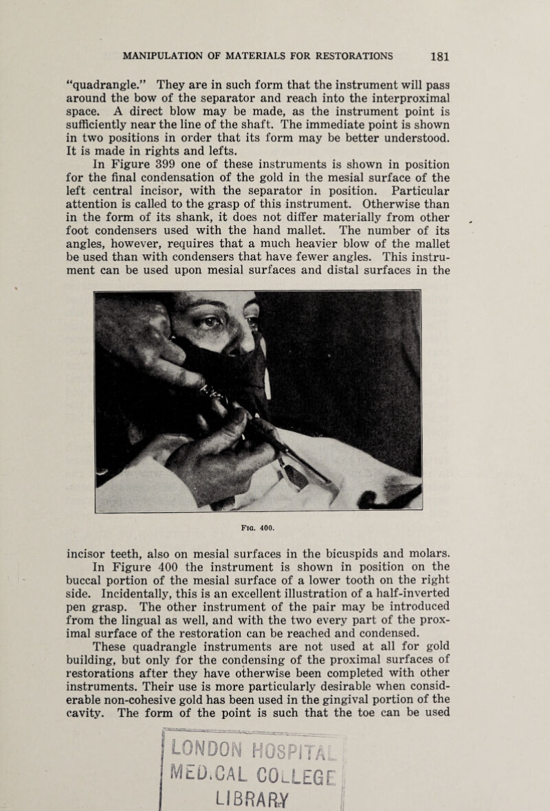 “quadrangle.” They are in such form that the instrument will pass around the bow of the separator and reach into the interproximal space. A direct blow may be made, as the instrument point is sufficiently near the line of the shaft. The immediate point is shown in two positions in order that its form may be better understood. It is made in rights and lefts. In Figure 899 one of these instruments is shown in position for the final condensation of the gold in the mesial surface of the left central incisor, with the separator in position. Particular attention is called to the grasp of this instrument. Otherwise than in the form of its shank, it does not differ materially from other foot condensers used with the hand mallet. The number of its angles, however, requires that a much heavier blow of the mallet be used than with condensers that have fewer angles. This instru¬ ment can be used upon mesial surfaces and distal surfaces in the Fig. 400. incisor teeth, also on mesial surfaces in the bicuspids and molars. In Figure 400 the instrument is shown in position on the buccal portion of the mesial surface of a lower tooth on the right side. Incidentally, this is an excellent illustration of a half-inverted pen grasp. The other instrument of the pair may be introduced from the lingual as well, and with the two every part of the prox¬ imal surface of the restoration can be reached and condensed. These quadrangle instruments are not used at all for gold building, but only for the condensing of the proximal surfaces of restorations after they have otherwise been completed with other instruments. Their use is more particularly desirable when consid¬ erable non-cohesive gold has been used in the gingival portion of the cavity. The form of the point is such that the toe can be used 1 LONDON HOSPITAL MEDICAL COlLEGE library I;
