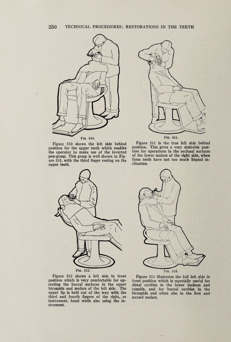 Figure 510 shows the left side behind position for the upper teeth which enables the operator to make use of the inverted pen-grasp. This grasp is well shown in Fig¬ ure 535, with the third finger resting on the upper teeth. Fig. 512. Figure 512 shows a left side in front position which is very comfortable for op¬ erating the buccal surfaces in the upper bicuspids and molars of the left side. The upper lip is held out of the way with the third and fourth fingers of the right, or instrument, hand while also using the in¬ strument. Figure 511 is the true left side behind position. This gives a very desirable posi¬ tion for operations in the occlusal surfaces of the lower molars of the right side, when these teeth have not too much lingual in¬ clination. Fig. 513. Figure 513 illustrates the full left side in front position which is especially useful for distal cavities in the lower incisors and cuspids, and for buccal cavities in the bicuspids and often also in the first and second molars.