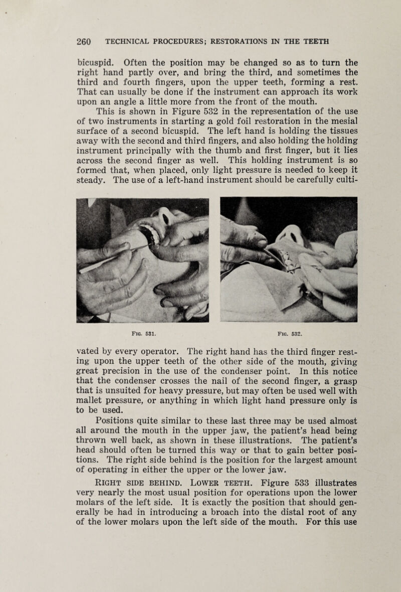 bicuspid. Often the position may be changed so as to turn the right hand partly over, and bring the third, and sometimes the third and fourth fingers, upon the upper teeth, forming a rest. That can usually be done if the instrument can approach its work upon an angle a little more from the front of the mouth. This is shown in Figure 532 in the representation of the use of two instruments in starting a gold foil restoration in the mesial surface of a second bicuspid. The left hand is holding the tissues away with the second and third fingers, and also holding the holding instrument principally with the thumb and first finger, but it lies across the second finger as well. This holding instrument is so formed that, when placed, only light pressure is needed to keep it steady. The use of a left-hand instrument should be carefully culti- Fig. 531. Fig. 532. vated by every operator. The right hand has the third finger rest¬ ing upon the upper teeth of the other side of the mouth, giving great precision in the use of the condenser point. In this notice that the condenser crosses the nail of the second finger, a grasp that is unsuited for heavy pressure, but may often be used well with mallet pressure, or anything in which light hand pressure only is to be used. Positions quite similar to these last three may be used almost all around the mouth in the upper jaw, the patient’s head being thrown well back, as shown in these illustrations. The patient’s head should often be turned this way or that to gain better posi¬ tions. The right side behind is the position for the largest amount of operating in either the upper or the lower jaw. Right side behind. Lower teeth. Figure 533 illustrates very nearly the most usual position for operations upon the lower molars of the left side. It is exactly the position that should gen¬ erally be had in introducing a broach into the distal root of any of the lower molars upon the left side of the mouth. For this use