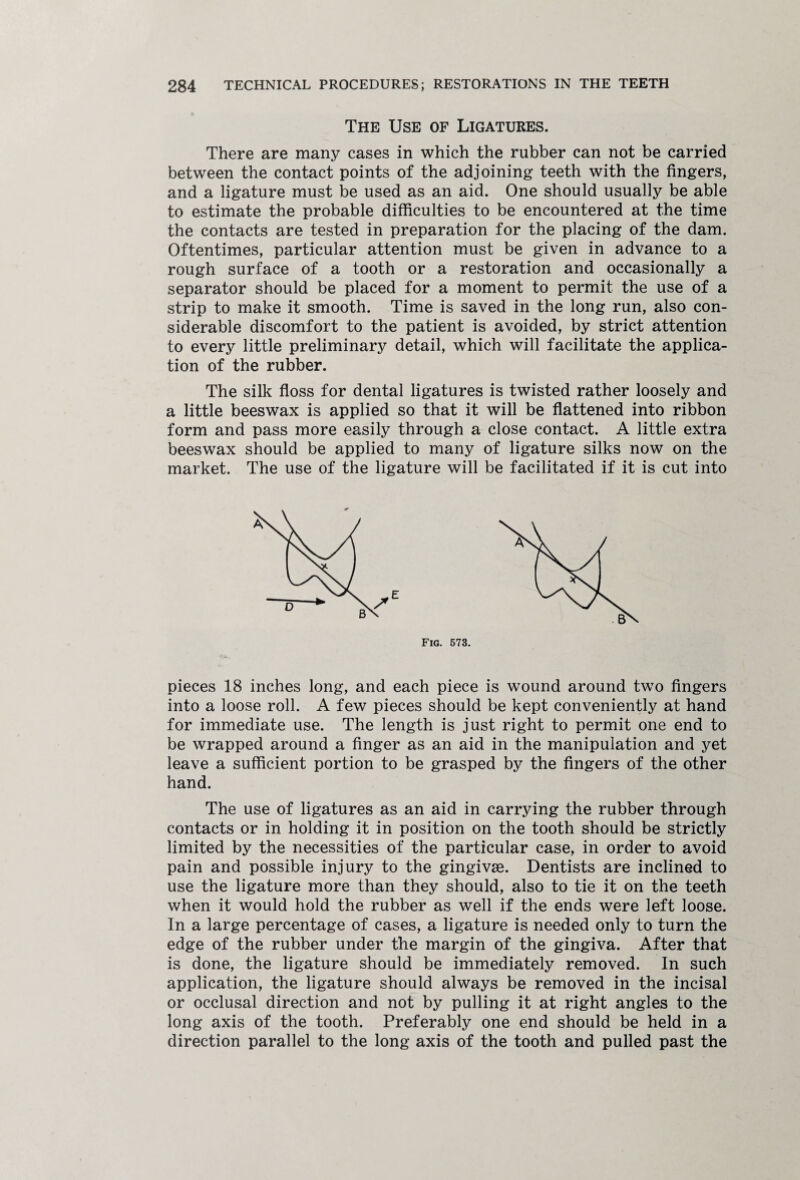 The Use of Ligatures. There are many cases in which the rubber can not be carried between the contact points of the adjoining teeth with the fingers, and a ligature must be used as an aid. One should usually be able to estimate the probable difficulties to be encountered at the time the contacts are tested in preparation for the placing of the dam. Oftentimes, particular attention must be given in advance to a rough surface of a tooth or a restoration and occasionally a separator should be placed for a moment to permit the use of a strip to make it smooth. Time is saved in the long run, also con¬ siderable discomfort to the patient is avoided, by strict attention to every little preliminary detail, which will facilitate the applica¬ tion of the rubber. The silk floss for dental ligatures is twisted rather loosely and a little beeswax is applied so that it will be flattened into ribbon form and pass more easily through a close contact. A little extra beeswax should be applied to many of ligature silks now on the market. The use of the ligature will be facilitated if it is cut into Fig. 573. pieces 18 inches long, and each piece is wound around two fingers into a loose roll. A few pieces should be kept conveniently at hand for immediate use. The length is just right to permit one end to be wrapped around a finger as an aid in the manipulation and yet leave a sufficient portion to be grasped by the fingers of the other hand. The use of ligatures as an aid in carrying the rubber through contacts or in holding it in position on the tooth should be strictly limited by the necessities of the particular case, in order to avoid pain and possible injury to the gingivse. Dentists are inclined to use the ligature more than they should, also to tie it on the teeth when it would hold the rubber as well if the ends were left loose. In a large percentage of cases, a ligature is needed only to turn the edge of the rubber under the margin of the gingiva. After that is done, the ligature should be immediately removed. In such application, the ligature should always be removed in the incisal or occlusal direction and not by pulling it at right angles to the long axis of the tooth. Preferably one end should be held in a direction parallel to the long axis of the tooth and pulled past the