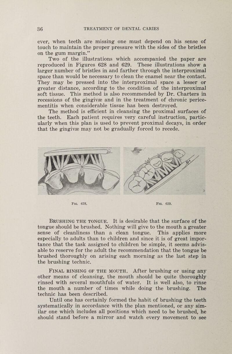 ever, when teeth are missing one must depend on his sense of touch to maintain the proper pressure with the sides of the bristles on the gum margin.” Two of the illustrations which accompanied the paper are reproduced in Figures 628 and 629. These illustrations show a larger number of bristles in and farther through the interproximal space than would be necessary to clean the enamel near the contact. They may be pressed into the interproximal space a lesser or greater distance, according to the condition of the interproximal soft tissue. This method is also recommended by Dr. Charters in recessions of the gingivae and in the treatment of chronic perice¬ mentitis when considerable tissue has been destroyed. The method is efficient in cleansing the proximal surfaces of the teeth. Each patient requires very careful instruction, partic¬ ularly when this plan is used to prevent proximal decays, in order that the gingivae may not be gradually forced to recede. Fig. 628. Fig. 629. Brushing the tongue. It is desirable that the surface of the tongue should be brushed. Nothing will give to the mouth a greater sense of cleanliness than a clean tongue. This applies more especially to adults than to children and since it is of great impor¬ tance that the task assigned to children be simple, it seems advis¬ able to reserve for the adult the recommendation that the tongue be brushed thoroughly on arising each morning as the last step in the brushing technic. Final rinsing of the mouth. After brushing or using any other means of cleansing, the mouth should be quite thoroughly rinsed with several mouthfuls of water. It is well also, to rinse the mouth a number of times while doing the brushing. The technic has been described. Until one has certainly formed the habit of brushing the teeth systematically in accordance with the plan mentioned, or any sim¬ ilar one which includes all positions which need to be brushed, he should stand before a mirror and watch every movement to see