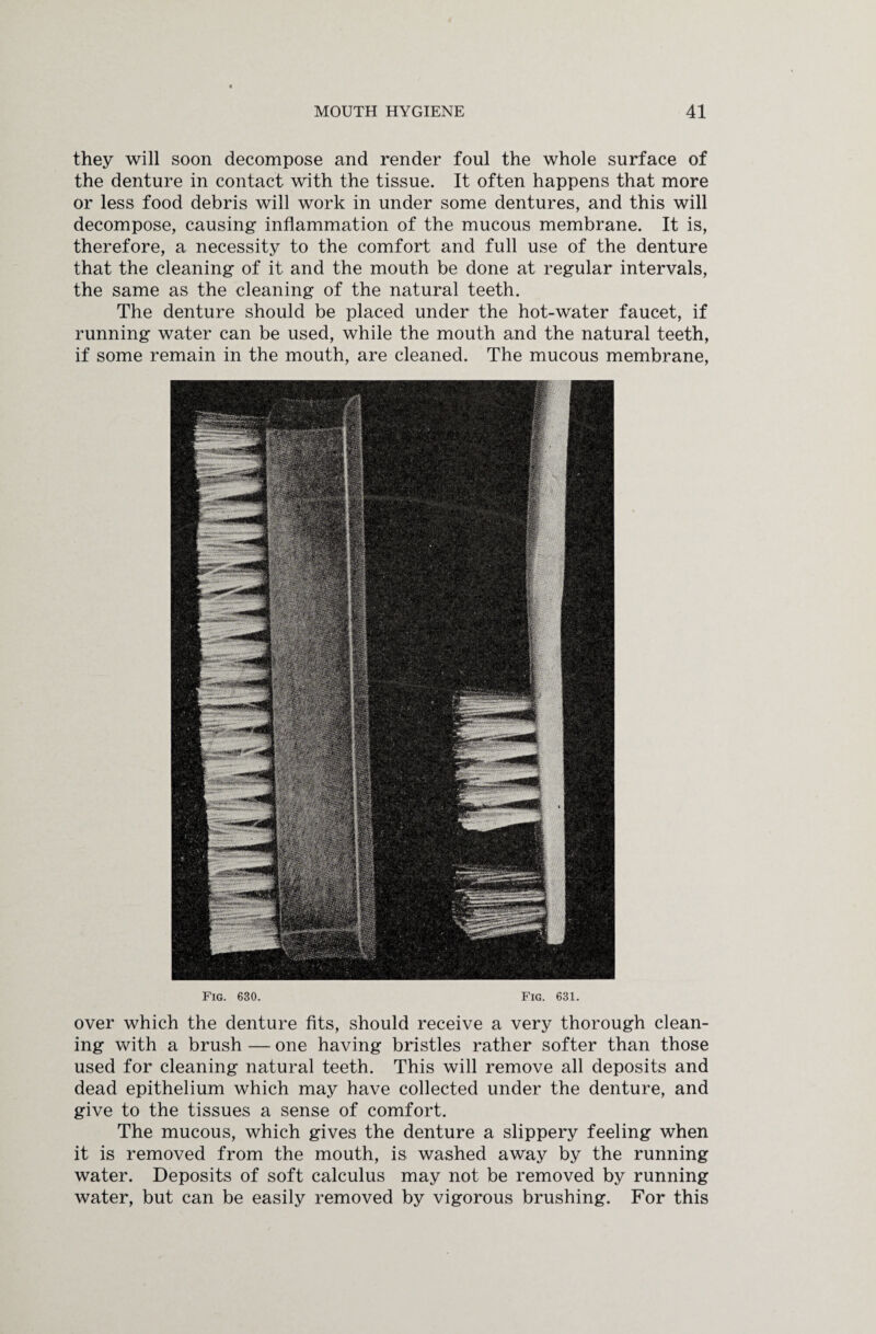 over which the denture fits, should receive a very thorough clean¬ ing with a brush — one having bristles rather softer than those used for cleaning natural teeth. This will remove all deposits and dead epithelium which may have collected under the denture, and give to the tissues a sense of comfort. The mucous, which gives the denture a slippery feeling when it is removed from the mouth, is washed away by the running water. Deposits of soft calculus may not be removed by running water, but can be easily removed by vigorous brushing. For this they will soon decompose and render foul the whole surface of the denture in contact with the tissue. It often happens that more or less food debris will work in under some dentures, and this will decompose, causing inflammation of the mucous membrane. It is, therefore, a necessity to the comfort and full use of the denture that the cleaning of it and the mouth be done at regular intervals, the same as the cleaning of the natural teeth. The denture should be placed under the hot-water faucet, if running water can be used, while the mouth and the natural teeth, if some remain in the mouth, are cleaned. The mucous membrane, Fig. 630. Fig. 631.