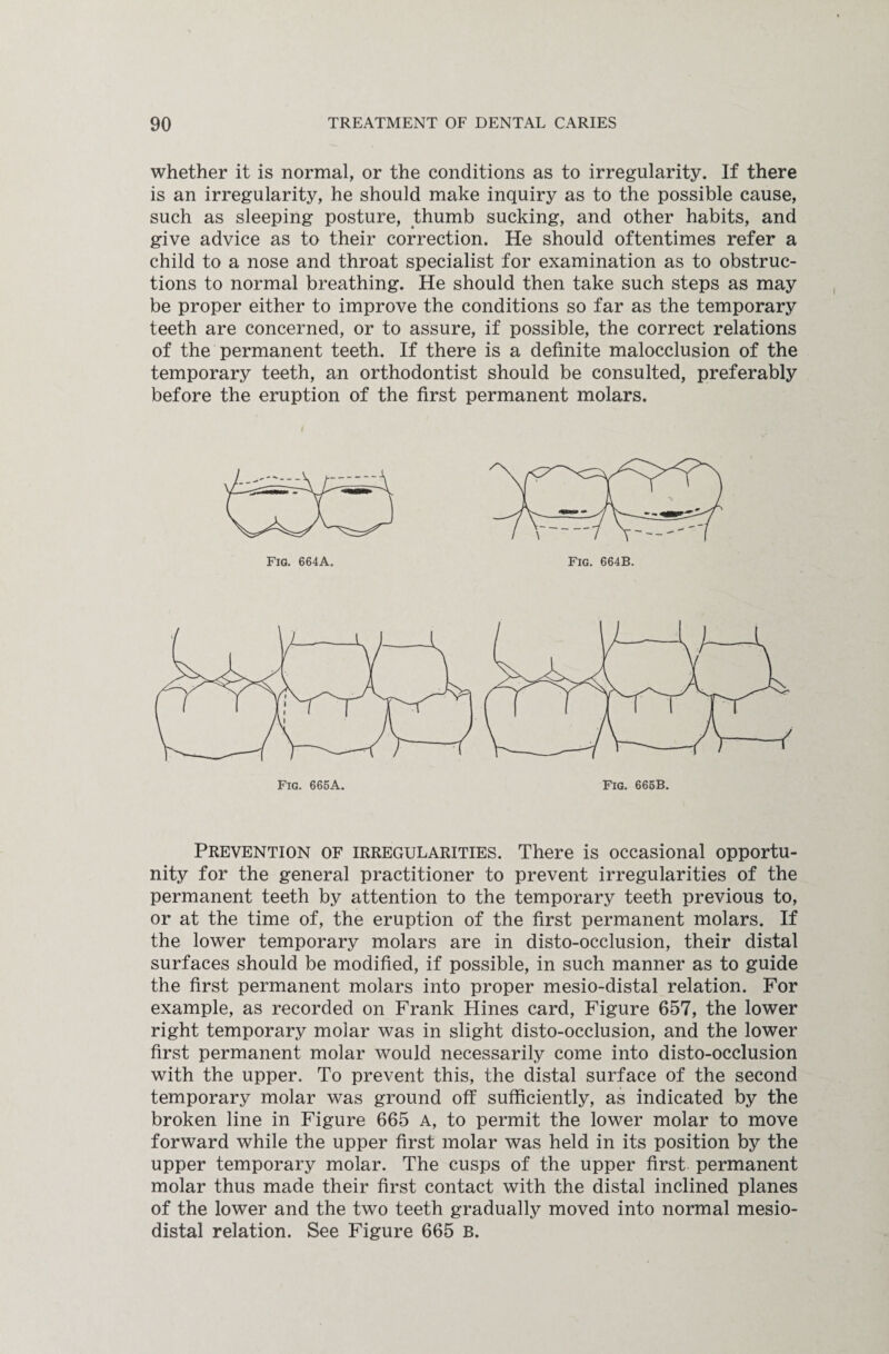 whether it is normal, or the conditions as to irregularity. If there is an irregularity, he should make inquiry as to the possible cause, such as sleeping posture, thumb sucking, and other habits, and give advice as to their correction. He should oftentimes refer a child to a nose and throat specialist for examination as to obstruc¬ tions to normal breathing. He should then take such steps as may be proper either to improve the conditions so far as the temporary teeth are concerned, or to assure, if possible, the correct relations of the permanent teeth. If there is a definite malocclusion of the temporary teeth, an orthodontist should be consulted, preferably before the eruption of the first permanent molars. Prevention of irregularities. There is occasional opportu¬ nity for the general practitioner to prevent irregularities of the permanent teeth by attention to the temporary teeth previous to, or at the time of, the eruption of the first permanent molars. If the lower temporary molars are in disto-occlusion, their distal surfaces should be modified, if possible, in such manner as to guide the first permanent molars into proper mesio-distal relation. For example, as recorded on Frank Hines card, Figure 657, the lower right temporary molar was in slight disto-occlusion, and the lower first permanent molar would necessarily come into disto-occlusion with the upper. To prevent this, the distal surface of the second temporary molar was ground off sufficiently, as indicated by the broken line in Figure 665 A, to permit the lower molar to move forward while the upper first molar was held in its position by the upper temporary molar. The cusps of the upper first permanent molar thus made their first contact with the distal inclined planes of the lower and the two teeth gradually moved into normal mesio- distal relation. See Figure 665 B.