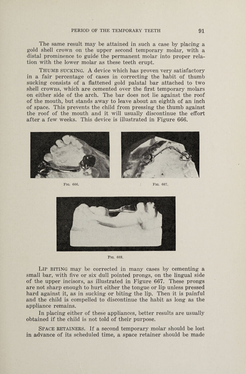 The same result may be attained in such a case by placing a gold shell crown on the upper second temporary molar, with a distal prominence to guide the permanent molar into proper rela¬ tion with the lower molar as these teeth erupt. Thumb sucking. A device which has proven very satisfactory in a fair percentage of cases in correcting the habit of thumb sucking consists of a flattened gold palatal bar attached to two shell crowns, which are cemented over the first temporary molars on either side of the arch. The bar does not lie against the roof of the mouth, but stands away to leave about an eighth of an inch of space. This prevents the child from pressing the thumb against the roof of the mouth and it will usually discontinue the effort after a few weeks. This device is illustrated in Figure 666. Fig. 666. Fig. 667. Fig. 668. Lip biting may be corrected in many cases by cementing a small bar, with five or six dull pointed prongs, on the lingual side of the upper incisors, as illustrated in Figure 667. These prongs are not sharp enough to hurt either the tongue or lip unless pressed hard against it, as in sucking or biting the lip. Then it is painful and the child is compelled to discontinue the habit as long as the appliance remains. In placing either of these appliances, better results are usually obtained if the child is not told of their purpose. Space retainers. If a second temporary molar should be lost in advance of its scheduled time, a space retainer should be made