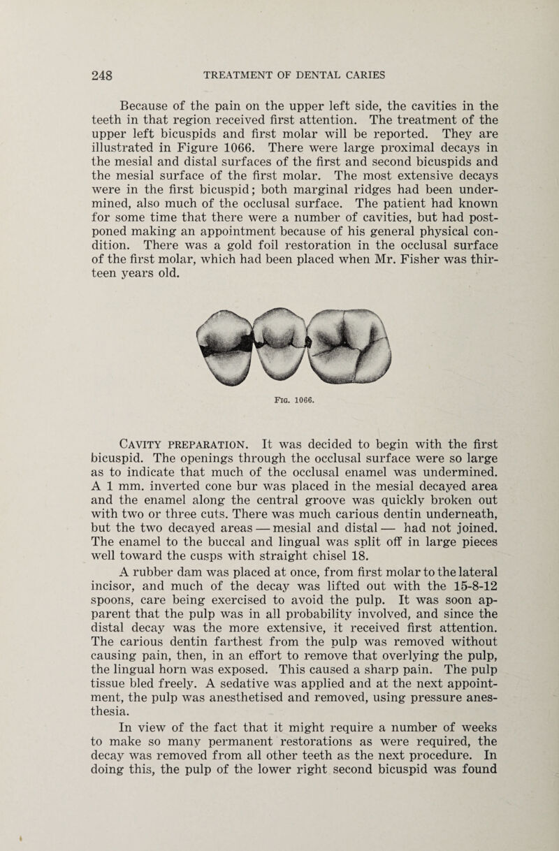 Because of the pain on the upper left side, the cavities in the teeth in that region received first attention. The treatment of the upper left bicuspids and first molar will be reported. They are illustrated in Figure 1066. There were large proximal decays in the mesial and distal surfaces of the first and second bicuspids and the mesial surface of the first molar. The most extensive decays were in the first bicuspid; both marginal ridges had been under¬ mined, also much of the occlusal surface. The patient had known for some time that there were a number of cavities, but had post¬ poned making an appointment because of his general physical con¬ dition. There was a gold foil restoration in the occlusal surface of the first molar, which had been placed when Mr. Fisher was thir¬ teen years old. Fig. 1066. Cavity preparation. It was decided to begin with the first bicuspid. The openings through the occlusal surface were so large as to indicate that much of the occlusal enamel was undermined. A 1 mm. inverted cone bur was placed in the mesial decayed area and the enamel along the central groove was quickly broken out with two or three cuts. There was much carious dentin underneath, but the two decayed areas — mesial and distal— had not joined. The enamel to the buccal and lingual was split off in large pieces well toward the cusps with straight chisel 18. A rubber dam was placed at once, from first molar to the lateral incisor, and much of the decay was lifted out with the 15-8-12 spoons, care being exercised to avoid the pulp. It was soon ap¬ parent that the pulp was in all probability involved, and since the distal decay was the more extensive, it received first attention. The carious dentin farthest from the pulp was removed without causing pain, then, in an effort to remove that overlying the pulp, the lingual horn was exposed. This caused a sharp pain. The pulp tissue bled freely. A sedative was applied and at the next appoint¬ ment, the pulp was anesthetised and removed, using pressure anes¬ thesia. In view of the fact that it might require a number of weeks to make so many permanent restorations as were required, the decay was removed from all other teeth as the next procedure. In doing this, the pulp of the lower right second bicuspid was found