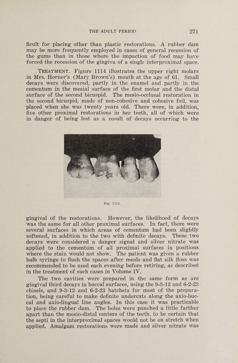 ficult for placing other than plastic restorations. A rubber dam may be more frequently employed in cases of general recession of the gums than in those where the impaction of food may have forced the recession of the gingiva of a single interproximal space. Treatment. Figure 1114 illustrates the upper right molars in Mrs. Horner's (Mary Brown's) mouth at the age of 61. Small decays were discovered, partly in the enamel and partly in the cementum in the mesial surface of the first molar and the distal surface of the second bicuspid. The mesio-occlusal restoration in the second bicuspid, made of non-cohesive and cohesive foil, was placed when she was twenty years old. There were, in addition, five other proximal restorations in her teeth, all of which were in danger of being lost as a result of decays occurring to the Fig. 1114. gingival of the restorations. However, the likelihood of decays was the same for all other proximal surfaces. In fact, there were several surfaces in which areas of cementum had been slightly softened, in addition to the two with definite decays. These two decays were considered a danger signal and silver nitrate was applied to the cementum of all proximal surfaces in positions where the stain would not show. The patient was given a rubber bulb syringe to flush the spaces after meals and flat silk floss was recommended to be used each evening before retiring, as described in the treatment of such cases in Volume IV. The two cavities were prepared in the same form as are gingival third decays in buccal surfaces, using the 9-3-12 and 6-2-23 chisels, and 9-3-12 and 6-2-23 hatchets for most of the prepara¬ tion, being careful to make definite undercuts along the axio-buc- cal and axio-lingual line angles. In this case it was practicable to place the rubber dam. The holes were punched a little farther apart than the mesio-distal centers of the teeth, to be certain that the septi in the interproximal spaces would not be on stretch when applied. Amalgam restorations were made and silver nitrate was