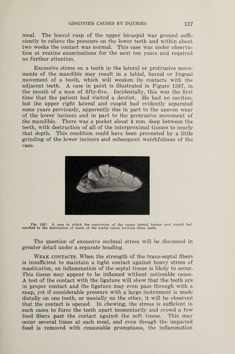 meal. The buccal cusp of the upper bicuspid was ground suffi¬ ciently to relieve the pressure on the lower teeth and within about two weeks the contact was normal. This case was under observa¬ tion at routine examinations for the next ten years and required no further attention. Excessive stress on a tooth in the lateral or protrusive move¬ ments of the mandible may result in a labial, buccal or lingual movement of a tooth, which will weaken its contacts with the adjacent teeth. A case in point is illustrated in Figure 1387, in the mouth of a man of fifty-five. Incidentally, this was the first time that the patient had visited a dentist. He had no cavities, but the upper right lateral and cuspid had evidently separated some years previously, apparently due in part to the uneven wear of the lower incisors and in part to the protrusive movement of the mandible. There was a pocket about 4 mm. deep between the teeth, with destruction of all of the interproximal tissues to nearly that depth. This condition could have been prevented by a little grinding of the lower incisors and subsequent watchfulness of the case. Fig. 1387. A case in which the separation of the upper lateral incisor and cuspid had resulted in the destruction of much of the septal tissue between these teeth. The question of excessive occlusal stress will be discussed in greater detail under a separate heading. Weak contacts. When the strength of the trans-septal fibers is insufficient to maintain a tight contact against heavy stress of mastication, an inflammation of the septal tissue is likely to occur. This tissue may appear to be inflamed without noticeable cause. A test of the contact with the ligature will show that the teeth are in proper contact and the ligature may even pass through with a snap, yet if considerable pressure with a large instrument is made distally on one tooth, or mesially on the other, it will be observed that the contact is opened. In chewing, the stress is sufficient in such cases to force the teeth apart momentarily and crowd a few food fibers past the contact against the soft tissue. This may occur several times at each meal, and even though the impacted food is removed with reasonable promptness, the inflammation