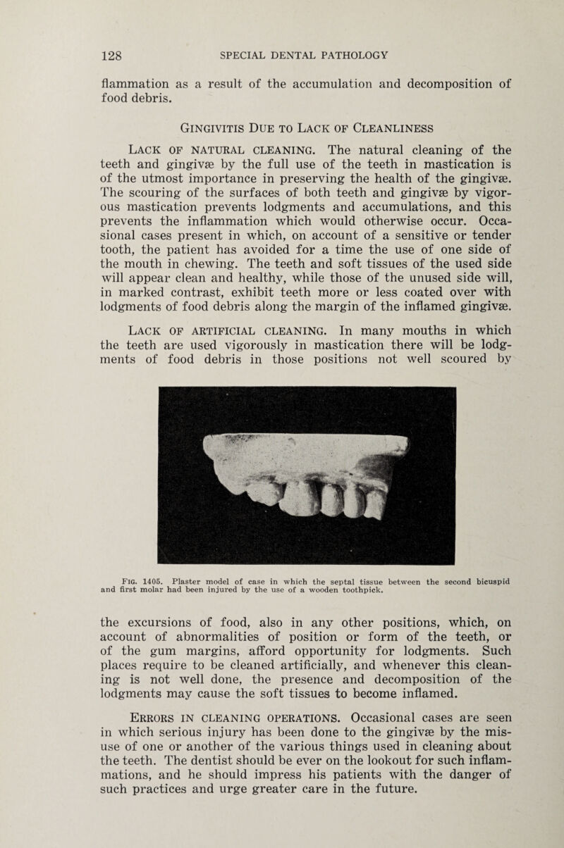 flammation as a result of the accumulation and decomposition of food debris. Gingivitis Due to Lack of Cleanliness Lack of natural cleaning. The natural cleaning of the teeth and gingivae by the full use of the teeth in mastication is of the utmost importance in preserving the health of the gingivae. The scouring of the surfaces of both teeth and gingivae by vigor¬ ous mastication prevents lodgments and accumulations, and this prevents the inflammation which would otherwise occur. Occa¬ sional cases present in which, on account of a sensitive or tender tooth, the patient has avoided for a time the use of one side of the mouth in chewing. The teeth and soft tissues of the used side will appear clean and healthy, while those of the unused side will, in marked contrast, exhibit teeth more or less coated over with lodgments of food debris along the margin of the inflamed gingivse. Lack of artificial cleaning. In many mouths in which the teeth are used vigorously in mastication there will be lodg¬ ments of food debris in those positions not well scoured by Fig. 1405. Plaster model of case in which the septal tissue between the second bicuspid and first molar had been injured by the use of a wooden toothpick. the excursions of food, also in any other positions, which, on account of abnormalities of position or form of the teeth, or of the gum margins, afford opportunity for lodgments. Such places require to be cleaned artificially, and whenever this clean¬ ing is not well done, the presence and decomposition of the lodgments may cause the soft tissues to become inflamed. Errors in cleaning operations. Occasional cases are seen in which serious injury has been done to the gingivse by the mis¬ use of one or another of the various things used in cleaning about the teeth. The dentist should be ever on the lookout for such inflam¬ mations, and he should impress his patients with the danger of such practices and urge greater care in the future.