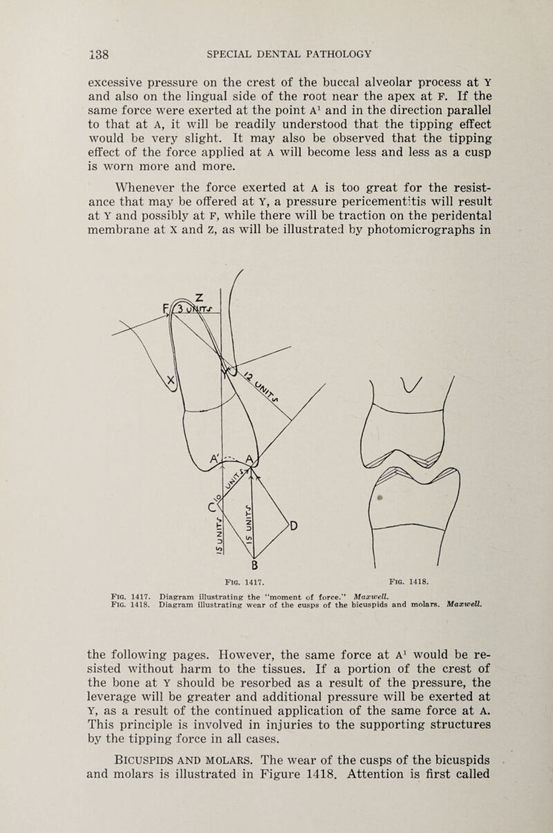 excessive pressure on the crest of the buccal alveolar process at Y and also on the lingual side of the root near the apex at F. If the same force were exerted at the point A1 and in the direction parallel to that at A, it will be readily understood that the tipping effect would be very slight. It may also be observed that the tipping effect of the force applied at a will become less and less as a cusp is worn more and more. Whenever the force exerted at A is too great for the resist¬ ance that may be offered at Y, a pressure pericementitis will result at Y and possibly at F, while there will be traction on the peridental membrane at x and z, as will be illustrated by photomicrographs in Fig. 1417. Diagram illustrating the “moment of force.” Maxwell. Fig. 1418. Diagram illustrating wear of the cusps of the bicuspids and molars. Maxwell. the following pages. However, the same force at A1 would be re¬ sisted without harm to the tissues. If a portion of the crest of the bone at Y should be resorbed as a result of the pressure, the leverage will be greater and additional pressure will be exerted at Y, as a result of the continued application of the same force at A. This principle is involved in injuries to the supporting structures by the tipping force in all cases. Bicuspids and molars. The wear of the cusps of the bicuspids and molars is illustrated in Figure 1418. Attention is first called