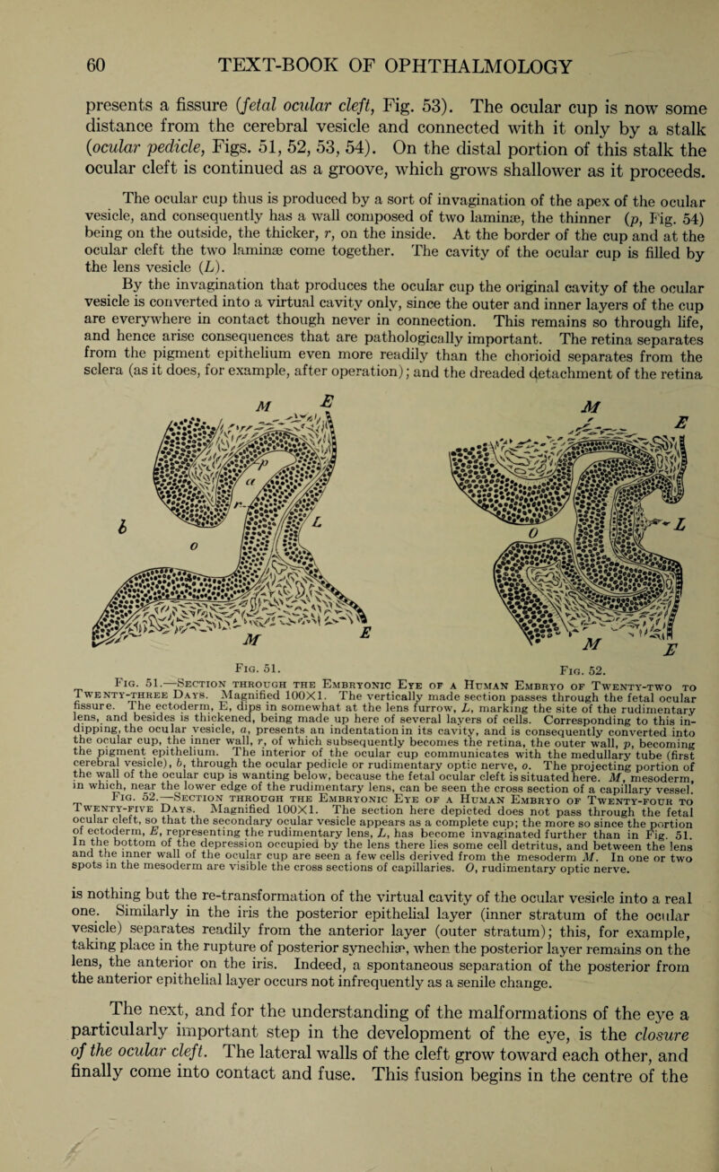 presents a fissure (fetal ocular cleft, Fig. 53). The ocular cup is now some distance from the cerebral vesicle and connected with it only by a stalk (ocular pedicle, Figs. 51, 52, 53, 54). On the distal portion of this stalk the ocular cleft is continued as a groove, which grows shallower as it proceeds. The ocular cup thus is produced by a sort of invagination of the apex of the ocular vesicle, and consequently has a wall composed of two laminae, the thinner (p, Fig. 54) being on the outside, the thicker, r, on the inside. At the border of the cup and at the ocular cleft the two laminae come together. The cavity of the ocular cup is filled by the lens vesicle (L). By the invagination that produces the ocular cup the original cavity of the ocular vesicle is converted into a virtual cavity only, since the outer and inner layers of the cup are everywhere in contact though never in connection. This remains so through life, and hence arise consequences that are pathologically important. The retina separates from the pigment epithelium even more readily than the chorioid separates from the sclera (as it does, for example, after operation); and the dreaded detachment of the retina Fig. 51. Fig. 52 Fig. 51. Section through the Embryonic Eye of a Human Embryo of Twenty-two to Twenty-three Days. Magnified 100X1. The vertically made section passes through the fetal ocular fissure. I he ectoderm, E, dips in somewhat at the lens furrow, L, marking the site of the rudimentary lens, and besides is thickened, being made up here of several layers of cells. Corresponding to this in- dipping, the ocular vesicle, a, presents an indentation in its cavity, and is consequently converted into the ocular cup, the inner wall, r, of which subsequently becomes the retina, the outer wall, p, becoming the pigment epithelium. The interior of the ocular cup communicates with the medullary tube (first cerebral vesicle), b, through the ocular pedicle or rudimentary optic nerve, o. The projecting portion of the wall of the ocular cup is wanting below, because the fetal ocular cleft is situated here. M, mesoderm, in which, near the lower edge of the rudimentary lens, can be seen the cross section of a capillary vessel. Fig. 52. Section through the Embryonic Eye of a Human Embryo of Twenty-four to Twenty-five Days. Magnified 100X1. The section here depicted does not pass through the fetal ocular cleft, so that the secondary ocular vesicle appears as a complete cup; the more so since the portion oi ectoderm, E, representing the rudimentary lens, L, has become invaginated further than in Fig. 51. In the bottom of the depression occupied by the lens there lies some cell detritus, and between the lens and the inner wall of the ocular cup are seen a few cells derived from the mesoderm M. In one or two spots in the mesoderm are visible the cross sections of capillaries. O, rudimentary optic nerve. is nothing but the re-transformation of the virtual cavity of the ocular vesicle into a real one. Similarly in the iris the posterior epithelial layer (inner stratum of the ocular vesicle) separates readily from the anterior layer (outer stratum); this, for example, taking place in the rupture of posterior synechisc, when the posterior layer remains on the lens, the anterior on the iris. Indeed, a spontaneous separation of the posterior from the anterior epithelial layer occurs not infrequently as a senile change. The next, and for the understanding of the malformations of the eye a particularly important step in the development of the eye, is the closure of the ocular cleft. The lateral walls of the cleft grow toward each other, and finally come into contact and fuse. This fusion begins in the centre of the