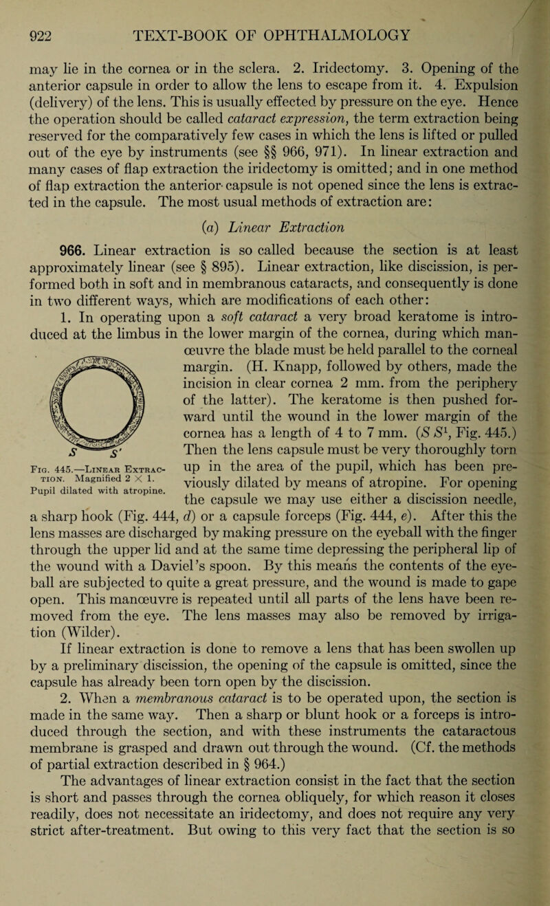 may lie in the cornea or in the sclera. 2. Iridectomy. 3. Opening of the anterior capsule in order to allow the lens to escape from it. 4. Expulsion (delivery) of the lens. This is usually effected by pressure on the eye. Hence the operation should be called cataract expression, the term extraction being reserved for the comparatively few cases in which the lens is lifted or pulled out of the eye by instruments (see §§ 966, 971). In linear extraction and many cases of flap extraction the iridectomy is omitted; and in one method of flap extraction the anterior- capsule is not opened since the lens is extrac¬ ted in the capsule. The most usual methods of extraction are: Fig. 445.—Linear Extrac¬ tion. Magnified 2X1. Pupil dilated with atropine. (a) Linear Extraction 966. Linear extraction is so called because the section is at least approximately linear (see § 895). Linear extraction, like discission, is per¬ formed both in soft and in membranous cataracts, and consequently is done in two different ways, which are modifications of each other: 1. In operating upon a soft cataract a very broad keratome is intro¬ duced at the limbus in the lower margin of the cornea, during which man¬ oeuvre the blade must be held parallel to the corneal margin. (H. Knapp, followed by others, made the incision in clear cornea 2 mm. from the periphery of the latter). The keratome is then pushed for¬ ward until the wound in the lower margin of the cornea has a length of 4 to 7 mm. (S S1, Fig. 445.) Then the lens capsule must be very thoroughly tom up in the area of the pupil, which has been pre¬ viously dilated by means of atropine. For opening the capsule we may use either a discission needle, a sharp hook (Fig. 444, d) or a capsule forceps (Fig. 444, e). After this the lens masses are discharged by making pressure on the eyeball with the finger through the upper lid and at the same time depressing the peripheral lip of the wound with a Daviel ’s spoon. By this means the contents of the eye¬ ball are subjected to quite a great pressure, and the wound is made to gape open. This manoeuvre is repeated until all parts of the lens have been re¬ moved from the eye. The lens masses may also be removed by irriga¬ tion (Wilder). If linear extraction is done to remove a lens that has been swollen up by a preliminary discission, the opening of the capsule is omitted, since the capsule has already been torn open by the discission. 2. When a membranous cataract is to be operated upon, the section is made in the same way. Then a sharp or blunt hook or a forceps is intro¬ duced through the section, and with these instruments the cataractous membrane is grasped and drawn out through the wound. (Cf. the methods of partial extraction described in § 964.) The advantages of linear extraction consist in the fact that the section is short and passes through the cornea obliquely, for which reason it closes readily, does not necessitate an iridectomy, and does not require any very strict after-treatment. But owing to this very fact that the section is so