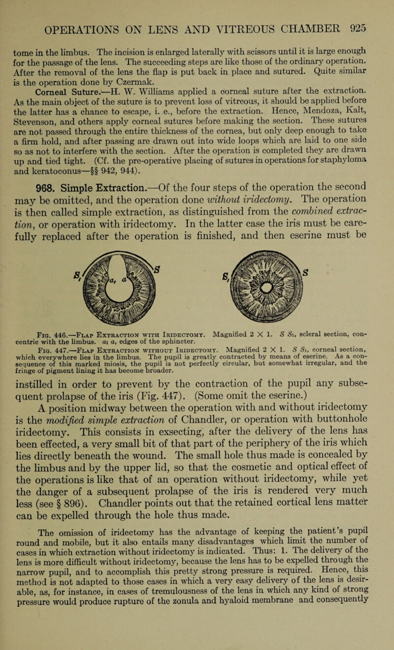 tome in the limbus. The incision is enlarged laterally with scissors until it is large enough for the passage of the lens. The succeeding steps are like those of the ordinary operation. After the removal of the lens the flap is put back in place and sutured. Quite similar is the operation done by Czermak. Corneal Suture:—H. W. Williams applied a corneal suture after the extraction. As the main object of the suture is to prevent loss of vitreous, it should be applied before the latter has a chance to escape, i. e., before the extraction. Hence, Mendoza, Kalt, Stevenson, and others apply corneal sutures before making the section. These sutures are not passed through the entire thickness of the cornea, but only deep enough to take a firm hold, and after passing are drawn out into wide loops which are laid to one side so as not to interfere with the section. After the operation is completed they are drawn up and tied tight. (Cf. the pre-operative placing of sutures in operations for staphyloma and keratoconus—§§ 942, 944). 968. Simple Extraction.—Of the four steps of the operation the second may be omitted, and the operation done without iridectomy. The operation is then called simple extraction, as distinguished from the combined extrac¬ tion, or operation with iridectomy. In the latter case the iris must be care¬ fully replaced after the operation is finished, and then eserine must be Fig. 446.—Flap Extraction with Iridectomy. Magnified 2X1. S Si, scleral section, con¬ centric with the limbus, ai a, edges of the sphincter. Fig. 447.—Flap Extraction without Iridectomy. Magnified 2X1. S Si, corneal section, which everywhere lies in the limbus. The pupil is greatly contracted by means of eserine. As a con¬ sequence of this marked miosis, the pupil is not perfectly circular, but somewhat irregular, and the fringe of pigment lining it has become broader. instilled in order to prevent by the contraction of the pupil any subse¬ quent prolapse of the iris (Fig. 447). (Some omit the eserine.) A position midway between the operation with and without iridectomy is the modified simple extraction of Chandler, or operation with buttonhole iridectomy. This consists in exsecting, after the delivery of the lens has been effected, a very small bit of that part of the periphery of the iris which lies directly beneath the wound. The small hole thus made is concealed by the limbus and by the upper lid, so that the cosmetic and optical effect of the operations is like that of an operation without iridectomy, while yet the danger of a subsequent prolapse of the iris is rendered very much less (see § 896). Chandler points out that the retained cortical lens matter can be expelled through the hole thus made. The omission of iridectomy has the advantage of keeping the patient’s pupil round and mobile, but it also entails many disadvantages which limit the number of cases in which extraction without iridectomy is indicated. Thus: 1. The delivery of the lens is more difficult without iridectomy, because the lens has to be expelled through the narrow pupil, and to accomplish this pretty strong pressure is required. Hence, this method is not adapted to those cases in which a very easy delivery of the lens is desir¬ able, as, for instance, in cases of tremulousness of the lens in which any kind of strong pressure would produce rupture of the zonula and hyaloid membrane and consequently