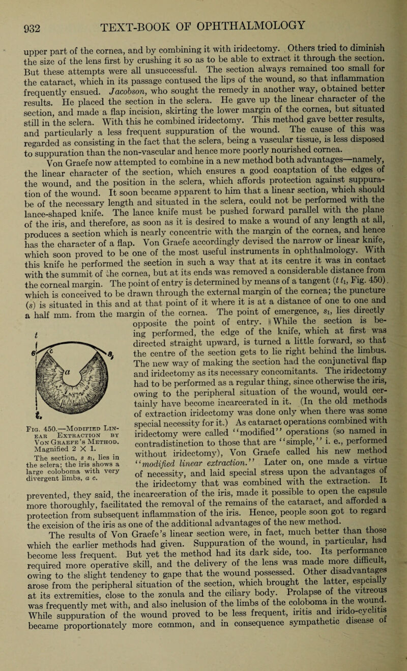 upper part of the cornea, and by combining it with iridectomy. Others tried to diminish the size of the lens first by crushing it so as to be able to extract it through the section. But these attempts were all unsuccessful. The section always remained too small for the cataract, which in its passage contused the lips of the wound, so that inflammation frequently ensued. Jacobson, who sought the remedy in another way, obtained better results. He placed the section in the sclera. He gave up the linear character of the section, and made a flap incision, skirting the lower margin of the cornea, but situated still in the sclera. With this he combined iridectomy. This method gave better results, and particularly a less frequent suppuration of the wound. The cause of this was regarded as consisting in the fact that the sclera, being a vascular tissue, is less disposed to suppuration than the non-vascular and hence more poorly nourished cornea. Von Graefe now attempted to combine in a new method both advantages namely, the linear character of the section, which ensures a good coaptation of the edges of the wound, and the position in the sclera, which affords protection against suppura¬ tion of the wound. It soon became apparent to him that a linear section, which should be of the necessary length and situated in the sclera, could not be performed with the lance-shaped knife. The lance knife must be pushed forward parallel with the plane of the iris, and therefore, as soon as it is desired to make a wound of any length at all, produces a section which is nearly concentric with the margin of the cornea, and hence has the character of a flap. Von Graefe accordingly devised the narrow or linear knife which soon proved to be one of the most useful instruments m ophthalmology. With this knife he performed the section in such a way that at its centre it was in contact with the summit of the cornea, but at its ends was removed a considerable distance from the corneal margin. The point of entry is determined by means of a tangent (t th Fig. 450). which is conceived to be drawn through the external margin of the cornea; the puncture (s) is situated in this and at that point of it where it is at a distance of one to one and a half mm. from the margin of the cornea. The point of emergence, sh lies directly opposite the point of entry, fi While the section is be¬ ing performed, the edge of the knife, which at first was directed straight upward, is turned a little forward, so that the centre of the section gets to lie right behind the limbus. The new way of making the section had the conjunctival flap and iridectomy as its necessary concomitants. The iridectomy had to be performed as a regular thing, since otherwise the ins, owing to the peripheral situation of the wound, would cer¬ tainly have become incarcerated in it. (In the old methods of extraction iridectomy was done only when there was some special necessity for it.) As cataract operations combined with iridectomy were called 11 modified ’ ’ operations (so named in contradistinction to those that are “simple, i. e., performed without iridectomy), Von Graefe called his new method “modified linear extraction.” Later on, one made a virtue of necessity, and laid special stress upon the advantages of the iridectomy that was combined with the extraction. It prevented, they said, the incarceration of the iris, made it possible to open the caPs^e more thoroughly, facilitated the removal of the remains of the cataract, and afforded a protection from subsequent inflammation of the iris. Hence, people soon got to regard the excision of the iris as one of the additional advantages of the new method. The results of Von Graefe’s linear section were, in fact, much better than those which the earlier methods had given. Suppuration of the wound, m particular, had become less frequent. But yet the method had its dark side, too. Its performance required more operative skill, and the delivery of the lens was made more difficult, owing to the slight tendency to gape that the wound possessed. Other disadvantages arose from the peripheral situation of the section, which brought the at er, espcia at its extremities, close to the zonula and the ciliary body. Prolapse o e V1 re0^ was frequently met with, and also inclusion of the limbs of the coloboma m e W01V) * While suppuration of the wound proved to be less frequent, iritis and indo-cychtis became proportionately more common, and in consequence sympat e ic isease Fig. 450.—Modified Lin¬ ear Extraction by Von Graefe’s Method. Magnified 2X1. The section, s si, lies in the sclera; the iris shows a large coloboma with very divergent limbs, a c.