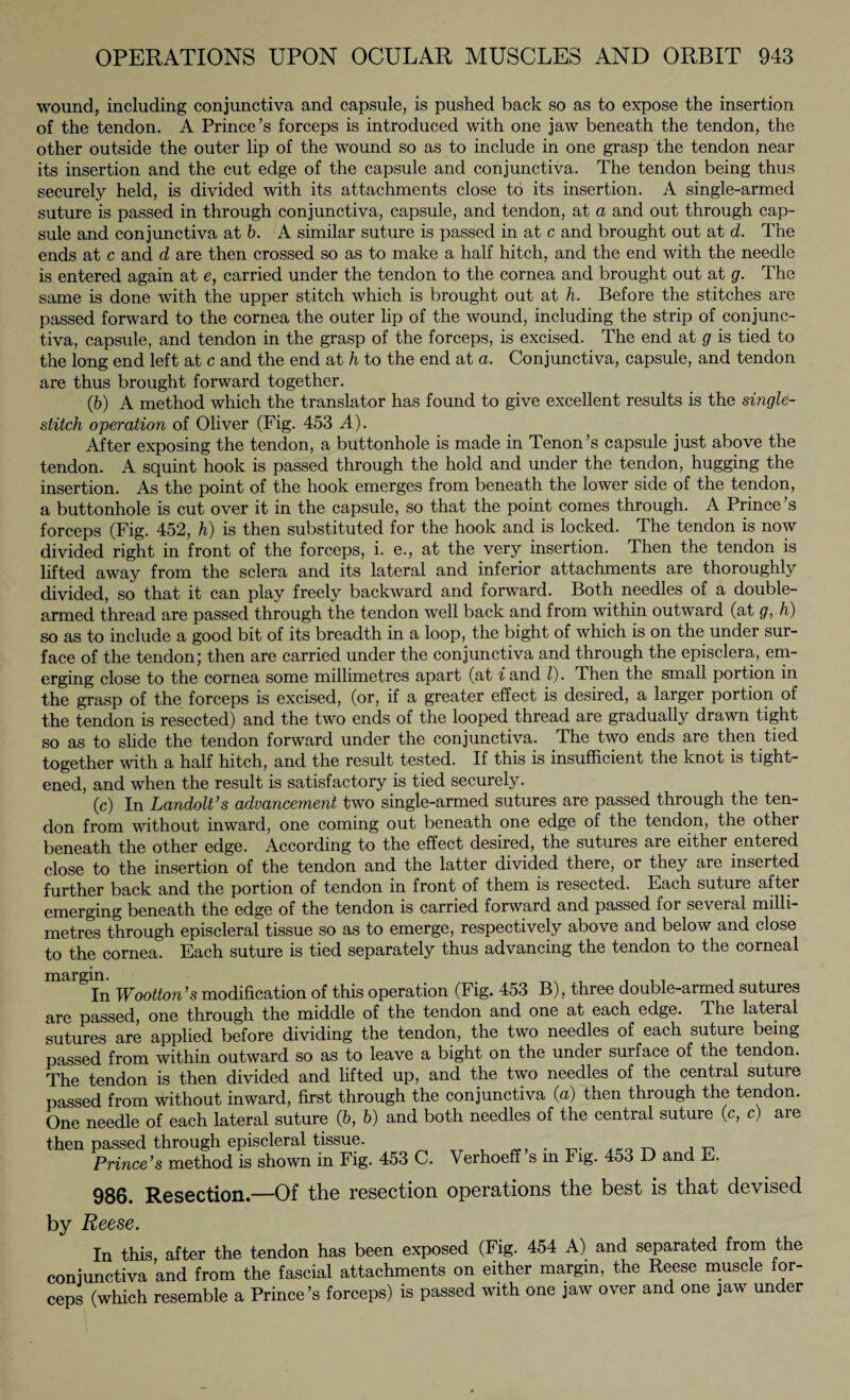 wound, including conjunctiva and capsule, is pushed back so as to expose the insertion of the tendon. A Prince’s forceps is introduced with one jaw beneath the tendon, the other outside the outer lip of the wound so as to include in one grasp the tendon near its insertion and the cut edge of the capsule and conjunctiva. The tendon being thus securely held, is divided with its attachments close to its insertion. A single-armed suture is passed in through conjunctiva, capsule, and tendon, at a and out through cap¬ sule and conjunctiva at b. A similar suture is passed in at c and brought out at d. The ends at c and d are then crossed so as to make a half hitch, and the end with the needle is entered again at e, carried under the tendon to the cornea and brought out at g. The same is done with the upper stitch which is brought out at h. Before the stitches are passed forward to the cornea the outer lip of the wound, including the strip of conjunc¬ tiva, capsule, and tendon in the grasp of the forceps, is excised. The end at g is tied to the long end left at c and the end at h to the end at a. Conjunctiva, capsule, and tendon are thus brought forward together. (b) A method which the translator has found to give excellent results is the single¬ stitch operation of Oliver (Fig. 453 A). After exposing the tendon, a buttonhole is made in Tenon’s capsule just above the tendon. A squint hook is passed through the hold and under the tendon, hugging the insertion. As the point of the hook emerges from beneath the lower side of the tendon, a buttonhole is cut over it in the capsule, so that the point comes through. A Prince ’s forceps (Fig. 452, h) is then substituted for the hook and is locked. The tendon is now divided right in front of the forceps, i. e., at the very insertion. Then the tendon is lifted away from the sclera and its lateral and inferior attachments are thoroughly divided, so that it can play freely backward and forward. Both needles of a double¬ armed thread are passed through the tendon well back and from within outward (at g, h) so as to include a good bit of its breadth in a loop, the bight of which is on the under sur¬ face of the tendon; then are carried under the conjunctiva and through the episclera, em¬ erging close to the cornea some millimetres apart (at i and l). Then the small portion in the grasp of the forceps is excised, (or, if a greater effect is desired, a larger portion of the tendon is resected) and the two ends of the looped thread are gradually drawn tight so as to slide the tendon forward under the conjunctiva. The two ends are then tied together with a half hitch, and the result tested. If this is insufficient the knot is tight¬ ened, and when the result is satisfactory is tied securely. (c) In Landolt’s advancement two single-armed sutures are passed through the ten¬ don from without inward, one coming out beneath one edge of the tendon, the other beneath the other edge. According to the effect desired, the sutures are either entered close to the insertion of the tendon and the latter divided there, or they are inserted further back and the portion of tendon in front of them is resected. Each suture after emerging beneath the edge of the tendon is carried forward and passed for several milli¬ metres through episcleral tissue so as to emerge, respectively above and below and close to the cornea. Each suture is tied separately thus advancing the tendon to the corneal margin. . _ . . . . In Wootton’s modification of this operation (Fig. 453 B), three double-armed sutures are passed, one through the middle of the tendon and one at each edge. The lateral sutures are applied before dividing the tendon, the two needles of each suture being passed from within outward so as to leave a bight on the under surface of the tendon. The tendon is then divided and lifted up, and the two needles of the central suture passed from without inward, first through the conjunctiva (a) then through the tendon. One needle of each lateral suture (b, b) and both needles of the central suture (c, c) are then passed through episcleral tissue. . - . _ Prince’s method is shown in Fig. 453 C. Verhoeff s in Fig. 453 D and E. 986. Resection.—Of the resection operations the best is that devised by Reese. In this, after the tendon has been exposed (Fig. 454 A) and separated from the conjunctiva and from the fascial attachments on either margin, the Reese muscle for¬ ceps (which resemble a Prince’s forceps) is passed with one jaw over and one jaw under