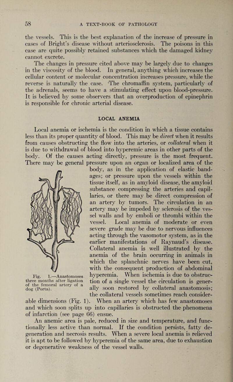 the vessels. This is the best explanation of the increase of pressure in cases of Bright’s disease without arteriosclerosis. The poisons in this case are quite possibly retained substances which the damaged kidney cannot excrete. The changes in pressure cited above may be largely due to changes in the viscosity of the blood. In general, anything which increases the cellular content or molecular concentration increases pressure, while the reverse is naturally the case. ’The chromaffin system, particularly of the adrenals, seems to have a stimulating effect upon blood-pressure. It is believed by some observers that an overproduction of epinephrin is responsible for chronic arterial disease. LOCAL ANEMIA Local anemia or ischemia is the condition in which a tissue contains less than its proper quantity of blood. This may be direct when it results from causes obstructing the flow into the arteries, or collateral when it is due to withdrawal of blood into hyperemic areas in other parts of the body. Of the causes acting directly, pressure is the most frequent. There may be general pressure upon an organ or localized area of the body, as in the application of elastic band¬ ages; or pressure upon the vessels within the tissue itself, as in amyloid disease, the amyloid substance compressing the arteries and capil¬ laries, or there may be direct compression of an artery by tumors. The circulation in an artery may be impeded by sclerosis of the ves¬ sel walls and by emboli or thrombi within the vessel. Local anemia of moderate or even severe grade may be due to nervous influences acting through the vasomotor system, as in the earlier manifestations of Raynaud’s disease. Collateral anemia is well illustrated bv the anemia of the brain occurring in animals in which the splanchnic nerves have been cut, with the consequent production of abdominal hyperemia. When ischemia is due to obstruc¬ tion of a single vessel the circulation is gener¬ ally soon restored by collateral anastomosis; the collateral vessels sometimes reach consider¬ able dimensions (Fig. 1). When an artery which has few anastomoses and which soon splits up into capillaries is obstructed the phenomena of infarction (see page 66) ensue. An anemic area is pale, reduced in size and temperature, and func¬ tionally less active than normal. If the condition persists, fatty de¬ generation and necrosis results. When a severe local anemia is relieved it is apt to be followed by hyperemia of the same area, due to exhaustion or degenerative weakness of the vessel walls. dog (Porta).