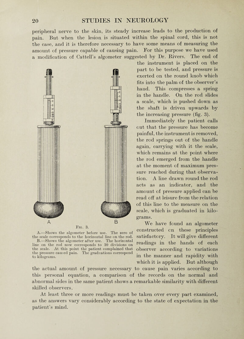 peripheral nerve to the skin, its steady increase leads to the production of pain. But when the lesion is situated within the spinal cord, this is not the case, and it is therefore necessary to have some means of measuring the amount of pressure capable of causing pain. For this purpose we have used a modification of Cattell’s algometer suggested by Dr. Rivers. The end of the instrument is placed on the part to be tested, and pressure is exerted on the round knob which fits into the palm of the observer’s hand. This compresses a spring in the handle. On the rod slides a scale, which is pushed down as the shaft is driven upwards by the increasing pressure (fig. 3). Immediately the patient calls out that the pressure has become painful, the instrument is removed, the rod springs out of the handle again, carrying with it the scale, which remains at the point where the rod emerged from the handle at the moment of maximum pres¬ sure reached during that observa¬ tion. A line drawn round the rod acts as an indicator, and the amount of pressure applied can be read off at leisure from the relation of this line to the measure on the scale, which is graduated in kilo¬ grams. We have found an algometer . ol ’ ’ mi , constructed on these principles A. —Snows the algometer betore use. ihe zero ot ... the scale corresponds to the horizontal line on the rod. satisfactory. It will give different B. — Shows the algometer after use. The horizontal rparnnD>q z- fup hnnrk of pnoh line on the rod now corresponds to 10 divisions on tradings in me nantlS OI eacil the scale. At this point the patient complained that observer according to variations the pressure caused pain. The graduations correspond . , . , . to kilograms. m the manner and rapidity with which it is applied. But although the actual amount of pressure necessary to cause pain varies according to this personal equation, a comparison of the records on the normal and abnormal sides in the same patient shows a remarkable similarity with different skilled observers. At least three or more readings must be taken over every part examined, as the answers vary considerably according to the state of expectation in the patient’s mind.