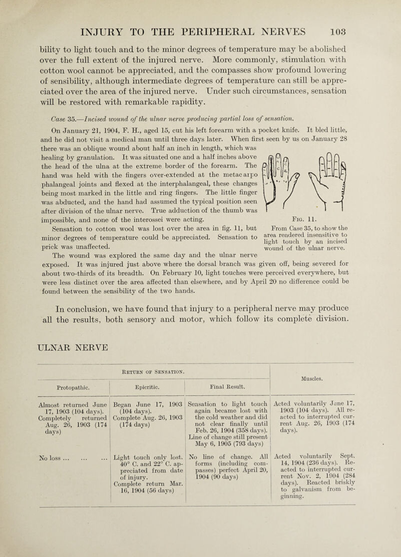 bility to light touch and to the minor degrees of temperature may be abolished over the full extent of the injured nerve. More commonly, stimulation with cotton wool cannot be appreciated, and the compasses show profound lowering of sensibility, although intermediate degrees of temperature can still be appre¬ ciated over the area of the injured nerve. Under such circumstances, sensation will be restored with remarkable rapidity. Case 35.—Incised wound of the ulnar nerve producing partial loss of sensation. On January 21, 1904, F. H., aged 15, cut his left forearm with a pocket knife. It bled little, and he did not visit a medical man until three days later. When first seen by us on January 28 there was an oblique wound about half an inch in length, which was healing by granulation. It was situated one and a half inches above the head of the ulna at the extreme border of the forearm. The hand was held with the fingers over-extended at the metacaipo phalangeal joints and flexed at the interphalangeal, these changes being most marked in the little and ring fingers. The little finger was abducted, and the hand had assumed the typical position seen after chvision of the ulnar nerve. True adduction of the thumb was impossible, and none of the interossei were acting. Sensation to cotton wool was lost over the area in fig. 11, but minor degrees of temperature could be appreciated. Sensation to prick was unaffected. The wound was explored the same day and the ulnar nerve exposed. It was injured just above where the dorsal branch was given off, being severed for about two-thirds of its breadth. On February 10, light touches were perceived everywhere, but were less distinct over the area affected than elsewhere, and by April 20 no difference could be found between the sensibility of the two hands. In conclusion, we have found that injury to a peripheral nerve may produce all the results, both sensory and motor, which follow its complete division. Fig. 11. From Case 35, to show the area rendered insensitive to light touch by an incised wound of the ulnar nerve. ULNAR NERVE Return of Sensation. Muscles. Protopathic. Epicritic. Final Result. Almost returned June 17, 1903 (104 days). Completely returned Aug. 26, 1903 (174 days) Began June 17, 1903 (104 days). Complete Aug. 26, 1903 (174 days) ^ Sensation to light touch again became lost with the cold weather and did not clear finally until Feb. 26, 1904 (358 days). Line of change still present May 6, 1905 (793 days) Acted voluntarily Jane 17, 1903 (104 days). All re¬ acted to interrupted cur¬ rent Aug. 26, 1903 (174 days). No loss. Light touch only lost. 40° C. and 22° C. ap¬ preciated from date of injury. Complete return Mar. 16, 1904 (56 days) No line of change. All forms (including com¬ passes) perfect April 20, 1904 (90 days) Acted voluntarily Sept. 14, 1904 (236 days). Re¬ acted to interrupted cur¬ rent Nov. 2, 1904 (284 days). Reacted briskly to galvanism from be¬ ginning.