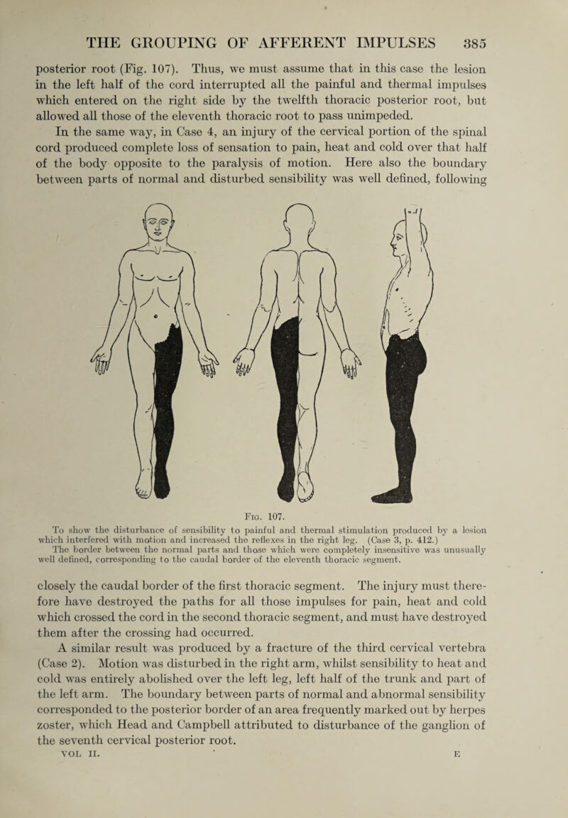 posterior root (Fig. 107). Thus, we must assume that in this case the lesion in the left half of the cord interrupted all the painful and thermal impulses which entered on the right side by the twelfth thoracic posterior root, but allowed all those of the eleventh thoracic root to pass unimpeded. In the same way, in Case 4, an injury of the cervical portion of the spinal cord produced complete loss of sensation to pain, heat and cold over that half of the body opposite to the paralysis of motion. Here also the boundary between parts of normal and disturbed sensibility was well defined, following Fig. 107. To show the disturbance of sensibility to painful and thermal stimulation produced by a lesion which interfered with motion and increased the reflexes in the right leg. (Case 3, p. 412.) The border between the normal parts and those which were completely insensitive was unusually well defined, corresponding to the caudal border of the eleventh thoracic segment. closely the caudal border of the first thoracic segment. The injury must there¬ fore have destroyed the paths for all those impulses for pain, heat and cold which crossed the cord in the second thoracic segment, and must have destroyed them after the crossing had occurred. A similar result was produced by a fracture of the third cervical vertebra (Case 2). Motion was disturbed in the right arm, whilst sensibility to heat and cold was entirely abolished over the left leg, left half of the trunk and part of the left arm. The boundary between parts of normal and abnormal sensibility corresponded to the posterior border of an area frequently marked out by herpes zoster, which Head and Campbell attributed to disturbance of the ganglion of the seventh cervical posterior root. VOL II. E