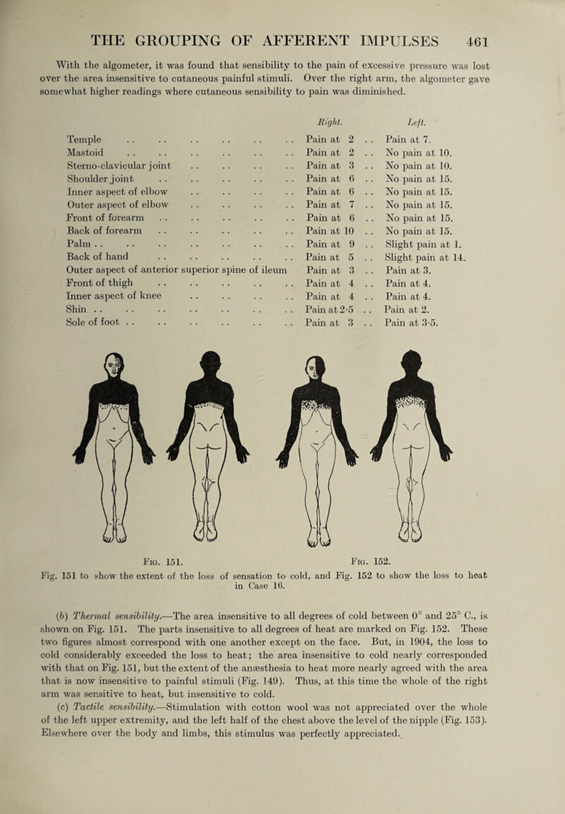 With the algometer, it was found that sensibility to the pain of excessive pressure was lost over the area insensitive to cutaneous painful stimuli. Over the right arm, the algometer gave somewhat higher readings where cutaneous sensibility to pain was diminished. Right. Left. Temple Pain at 2 . . Pain at 7. Mastoid Pain at 2 No pain at 10. Sterno-clavicular joint Pain at 3 No pain at 10. Shoulder joint Pain at 6 No pain at 15. Inner aspect of elbow Pain at 6 . . No pain at 15. Outer aspect of elbow Pain at 7 No pain at 15. Front of forearm . . Pain at 6 . . No pain at 15. Back of forearm . . Pain at 10 No pain at 15. Palm . . Pain at 9 Slight pain at 1. Back of hand • • Pain at 5 Slight pain at 14. Outer aspect of anterior superior spine of ileum Pain at 3 Pain at 3. Front of thigh • • . • Pain at 4 . . Pain at 4. Inner aspect of knee . . Pain at 4 Pain at 4. Shin Pain at 2-5 Pain at 2. Sole of foot . . Pain at 3 Pain at 3-5. Fig. 151. Fig. 152. Fig. 151 to show the extent of the loss of sensation to cold, and Fig. 152 to show the loss to heat in Case 16. (6) Thermal sensibility.—The area insensitive to all degrees of cold between 0° and 25° C., is shown on Fig. 151. The parts insensitive to all degrees of heat are marked on Fig. 152. These two figures almost correspond with one another except on the face. But, in 1904, the loss to cold considerably exceeded the loss to heat; the area insensitive to cold nearly corresponded with that on Fig. 151, but the extent of the anaesthesia to heat more nearly agreed with the area that is now insensitive to painful stimuli (Fig. 149). Thus, at this time the whole of the right arm was sensitive to heat, but insensitive to cold. (c) Tactile sensibility.—Stimulation with cotton wool was not appreciated over the whole of the left upper extremity, and the left half of the chest above the level of the nipple (Fig. 153). Elsewhere over the body and limbs, this stimulus was perfectly appreciated..