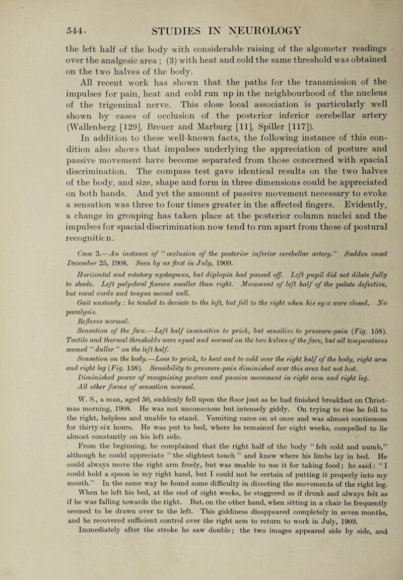 the left half of the body with considerable raising of the algometer readings over the analgesic area ; (3) with heat and cold the same threshold was obtained on the two halves of the body. All recent work has shown that the paths for the transmission of the impulses for pain, heat and cold run up in the neighbourhood of the nucleus of the trigeminal nerve. This close local association is particularly well shown by cases of occlusion of the posterior inferior cerebellar artery (Wallenberg [129], Breuer and Marburg [11], Spiller [117]). In addition to these well-known facts, the following instance of this con¬ dition also shows that impulses underlying the appreciation of posture and passive movement have become separated from those concerned with spacial discrimination. The compass test gave identical results on the two halves of the body, and size, shape and form in three dimensions could be appreciated on both hands. And yet the amount of passive movement necessary to evoke a sensation was three to four times greater in the affected fingers. Evidently, a change in grouping has taken place at the posterior column nuclei and the impulses for spacial discrimination now tend to run apart from those of postural recognition. Case 3.—An instance of “ occlusion of the posterior inferior cerebellar artery.” Sudden onset December 25, 1908. Seen by us first in July, 1909. Horizontal and rotatory nystagmus, but diplopia had passed off. Left pupil did not dilate fully to shade. Left palpebral fissure smaller than right. Movement of left half of the palate defective, but vocal cords and tongue moved well. Gait unsteady : he tended to deviate to the left, but fell to the right when his eyes were closed. No paralysis. Reflexes normal. Sensation of the face.—Left half insensitive to prick, but sensitive to pressure-pain (Fig. 158). Tactile and thermal thresholds were equal and normal on the two halves of the face, but all temperatures seemed “ duller ” on the left half. Sensation on the body.—Loss to prick, to heat and to cold over the right half of the body, right arm and right leg (Fig. 158). Sensibility to pressure-pain diminished over this area but not lost. Diminished power of recognising posture and passive movement in right arm and right leg. All other forms of sensation normal. W. S., a man, aged 50, suddenly fell upon the floor just as he had finished breakfast on Christ¬ mas morning, 1908. He was not unconscious but intensely giddy. On trying to rise he fell to the right, helpless and unable to stand. Vomiting came on at once and was almost continuous for thirty-six hours. He was put to bed, where he remained for eight weeks, compelled to lie almost constantly on his left side. From the beginning, he complained that the right half of the body “felt cold and numb,” although he could appreciate “ the slightest touch ” and knew where his limbs lay in bed. He could always move the right arm freely, but was unable to use it for taking food; he said: “I could hold a spoon in my right hand, but I could not be certain of putting it properly into my mouth.” In the same way he found some difficulty in directing the movements of the right leg. When he left his bed, at the end of eight weeks, he staggered as if drunk and always felt as if he was falling towards the right. But, on the other hand, when sitting in a chair he frequently seemed to be drawn over to the left. This giddiness disappeared completely in seven months, and he recovered sufficient control over the right arm to return to work in July, 1909. Immediately after the stroke he saw double; the two images appeared side by side, and