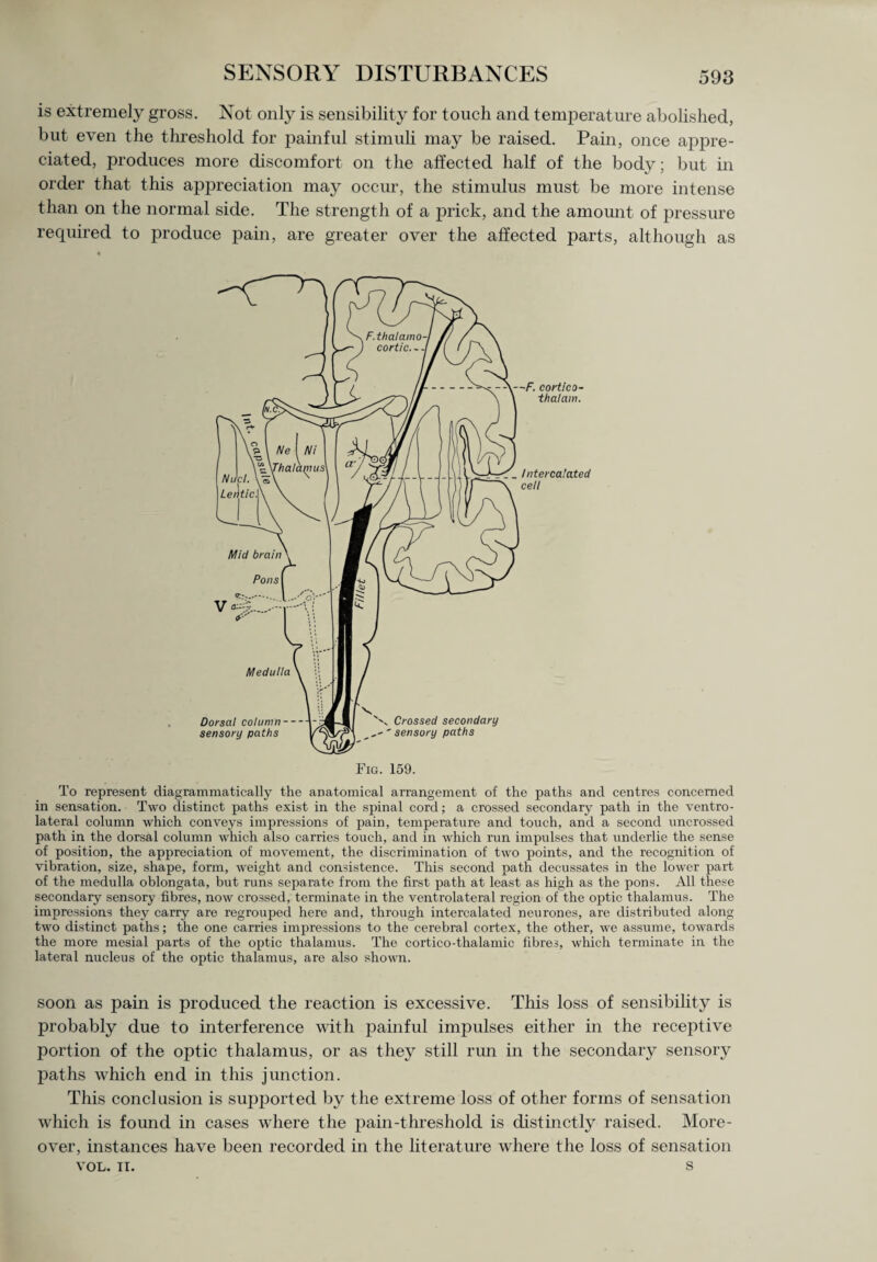 is extremely gross. Not only is sensibility for touch and temperature abolished, but even the threshold for painful stimuli may be raised. Pain, once appre¬ ciated, produces more discomfort on the affected half of the body; but in order that this appreciation may occur, the stimulus must be more intense than on the normal side. The strength of a prick, and the amount of pressure required to produce pain, are greater over the affected parts, although as To represent cliagrammatically the anatomical arrangement of the paths and centres concerned in sensation. Two distinct paths exist in the spinal cord; a crossed secondary path in the ventro¬ lateral column which conveys impressions of pain, temperature and touch, and a second uncrossed path in the dorsal column which also carries touch, and in which run impulses that underlie the sense of position, the appreciation of movement, the discrimination of two points, and the recognition of vibration, size, shape, form, weight and consistence. This second path decussates in the lower part of the medulla oblongata, but runs separate from the first path at least as high as the pons. All these secondary sensory fibres, now crossed, terminate in the ventrolateral region of the optic thalamus. The impressions they carry are regrouped here and, through intercalated neurones, are distributed along two distinct paths; the one carries impressions to the cerebral cortex, the other, we assume, towards the more mesial parts of the optie thalamus. The cortico-thalamic fibres, which terminate in the lateral nucleus of the optic thalamus, are also shown. soon as pain is produced the reaction is excessive. This loss of sensibility is probably due to interference with painful impulses either in the receptive portion of the optic thalamus, or as they still rim in the secondary sensory paths which end in this junction. This conclusion is supported by the extreme loss of other forms of sensation which is found in cases where the pain-thresholcl is distinctly raised. More¬ over, instances have been recorded in the literature where the loss of sensation VOL. ti. s