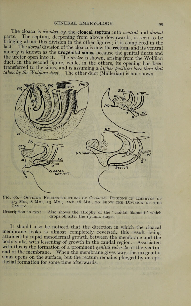 99 The cloaca is divided by the cloacal septum into ventral and dorsal parts. The septum, deepening from above downwards, is seen to be bringing about this division in the other figures; it is completed in the last. 1 he dorsal division of the cloaca is now the rectum, and its ventral moiety is known as the urogenital sinus, because the genital ducts and the ureter open into it. The ureter is shown, arising from the Wolffian duct, in the second figure, while, in the others, its opening has been transferred to the sinus, and is assuming a higher position here than that taken by the Wolffian duct. The other duct (Mullerian) is not shown. Fig. 66.—Outline Reconstructions of Cloacal Regions in Embryos of 4-5 Mm., 8 Mm., 13 Mm., and 18 Mm., to show the Division of this Cavity. Description in text. Also shows the atrophy of the ‘ caudal filament,' which drops off after the 13 mm. stage. It should also be noticed that the direction in which the cloacal membrane looks is almost completely reversed, this result being attained by rapid mesodermal growth between the membrane and the body-stalk, with lessening of growth in the caudal region. Associated with this is the formation of a prominent genital tubercle at the ventral end of the membrane. When the membrane gives way, the urogenital sinus opens on the surface, but the rectum remains plugged by an epi¬ thelial formation for some time afterwards.