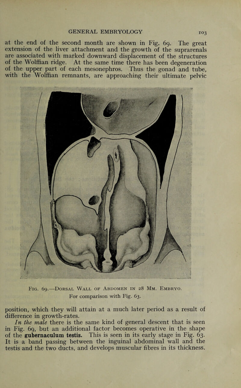 at the end of the second month are shown in Fig. 69. The great extension of the liver attachment and the growth of the suprarenals are associated with marked downward displacement of the structures of the Wolffian ridge. At the same time there has been degeneration of the upper part of each mesonephros. Thus the gonad and tube, with the Wolffian remnants, are approaching their ultimate pelvic Fig. 69.—Dorsal Wall of Abdomen in 28 Mm. Embryo. For comparison with Fig. 63. position, which they will attain at a much later period as a result of difference in growth-rates. In the male there is the same kind of general descent that is seen in Fig. 69, but an additional factor becomes operative in the shape of the gubernaculum testis. This is seen in its early stage in Fig. 63. It is a band passing between the inguinal abdominal wall and the testis and the two ducts, and develops muscular fibres in its thickness.