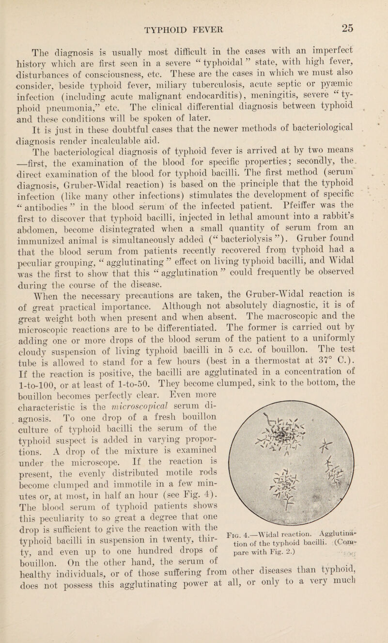 The diagnosis is usually most difficult in the cases with an imperfect history which are first seen in a severe u typhoidal ” state, with high fever, disturbances of consciousness, etc. These are the cases in which we must also consider, beside typhoid fever, miliary tuberculosis, acute septic or pyasmic infection (including acute malignant endocarditis), meningitis, severe “ ty¬ phoid pneumonia,” etc. The clinical differential diagnosis between typhoid and these conditions will be spoken of later. It is just in these doubtful cases that the newer methods of bacteriological diagnosis render incalculable aid. The bacteriological diagnosis of typhoid fever is arrived at by two means —first, the examination of the blood for specific properties; secondly, the direct examination of the blood for typhoid bacilli. The first method (serum diagnosis, Gruber-Widal reaction) is based on the principle that the typhoid infection (like many other infections) stimulates the development of specific “ antibodies ” in the blood serum of the infected patient. Pfeiffer was the first to discover that typhoid bacilli, injected in lethal amount into a rabbit’s abdomen, become disintegrated when a small quantity of serum from an immunized animal is simultaneously added (“ bacteriolysis ”). Gruber found that the blood serum from patients recently recovered from typhoid had a peculiar grouping, u agglutinating ” effect on living typhoid bacilli, and W idal was the first to show that this “ agglutination ” could frequently be observed during the course of the disease. When the necessary precautions are taken, the Gruber-Widal reaction is of great practical importance. Although not absolutely diagnostic, it is of great weight both when present and when absent. The macroscopic and the microscopic reactions are to be differentiated. The former is earned out by adding one or more drops of the blood serum of the patient to a uniformly cloudy suspension of living typhoid bacilli in o c.c. of bouillon, 4 he test tube is allowed to stand for a few hours (best in a thermostat at 37° C.). If the reaction is positive, the bacilli are agglutinated in a concentration of l-to-100, or at least of l-to-50. They become clumped, sink to the bottom, the bouillon becomes perfectly clear. Even more characteristic is the microscopical serum di¬ agnosis. To one drop of a fresh bouillon culture of typhoid bacilli the serum of the typhoid suspect is added in varying propor¬ tions. A drop of the mixture is examined under the microscope. If the reaction is present, the evenly distributed motile rods become clumped and immotile in a few min¬ utes or, at most, in half an hour (see Fig. 4). The blood serum of typhoid patients shows this peculiarity to so great a degree that one drop is sufficient to give the reaction with the typhoid bacilli in suspension in twenty, thir¬ ty, and even up to one hundred drops of bouillon. On the other hand, the serum of _ healthy individuals, or of those suffering from other diseases than typhoid, does not possess this agglutinating power at all, or only to a very much Fig. 4.—Widal reaction. Agglutina¬ tion of the typhoid bacilli. (Co,na- pare with Fig. 2.) ; :„r;