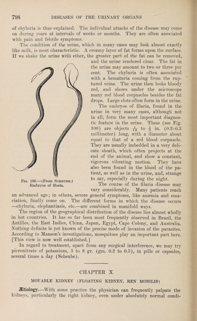 of chyluria is thus explained. The individual attacks of the disease may come on during years at intervals of weeks or months. They are often associated with pain and febrile symptoms. The condition of the urine, which in many cases may look almost exactly like milk, is most characteristic. A creamy layer of fat forms upon the surface. If we shake the urine with ether, the greater part of the fat can be removed, and the urine rendered clear. The fat in the urine may amount to two or three per cent. The chyluria is often associated with a hematuria coming from the rup¬ tured veins. The urine then looks bloody red, and shows under the microscope many red blood corpuscles besides the fat drops. Large clots often form in the urine. The embryos of filaria, found in the urine in very many cases, although not in all, form the most important diagnos¬ tic feature in the urine. These (see Fig. 100) are objects to in. (0.2-0.3 millimeter) long, with a diameter about equal to that of a red blood corpuscle. They are usually imbedded in a very deli¬ cate sheath, which often projects at the end of the animal, and show a constant, vigorous vibrating motion. They have also been found in the blood of the pa¬ tient, as well as in the urine, and, strange to say, especially during the night. The course of the filaria disease may vary considerably. Many patients reach an advanced age; in others, severe general symptoms, like anaemia and ema¬ ciation, finally come on. The different forms in which the disease occurs —clryluria, elephantiasis, etc.—are combined in manifold ways. The region of the geographical distribution of the disease lies almost wholly in hot countries. It has so far been most frequently observed in Brazil, the Antilles, the East Indies, China, Japan, Egypt, Cape Colony, and Australia. Nothing definite is yet known of the precise mode of invasion of the parasites. According to Manson’s investigations, mosquitoes play an important part here. [This view is now well established.] In regard to treatment, apart from any surgical interference, we may try picronitrate of potassium, 3 to 8 gr. (gm. 0.2 to 0.5), in pills or capsules, .several times a day (Seheube). Fig. 100.—(From Scheube.) Embryos of filaria. CHAPTER X MOVABLE KIDNEY (FLOATING KIDNEY, REN MOBILIS) etiology.—With some practice the physician can frequently palpate the kidneys, particularly the right kidney, even under absolutely normal condi-