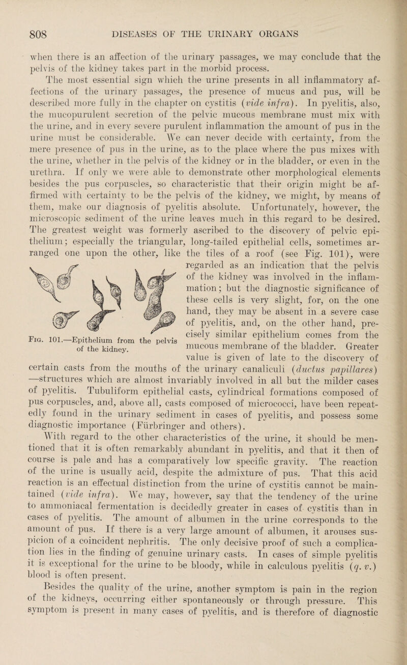 when there is an affection of the urinary passages, we may conclude that the pelvis of the kidney takes part in the morbid process. The most essential sign which the urine presents in all inflammatory af¬ fections of the urinary passages, the presence of mucus and pus, will be described more fully in the chapter on cystitis (vide infra). In pyelitis, also, the mucopurulent secretion of the pelvic mucous membrane must mix with the urine, and in every severe purulent inflammation the amount of pus in the urine must be considerable. We can never decide with certainty, from the mere presence of pus in the urine, as to the place where the pus mixes with the urine, whether in the pelvis of the kidney or in the bladder, or even in the urethra. If only we were able to demonstrate other morphological elements besides the pus corpuscles, so characteristic that their origin might be af¬ firmed with certainty to be the pelvis of the kidney, we might, by means of them, make our diagnosis of pyelitis absolute. Unfortunately, however, the microscopic sediment of the urine leaves much in this regard to be desired. The greatest weight was formerly ascribed to the discovery of pelvic epi¬ thelium; especially the triangular, long-tailed epithelial cells, sometimes ar¬ ranged one upon the other, like the tiles of a roof (see Fig. 101), were regarded as an indication that the pelvis of the kidney was involved in the inflam¬ mation; but the diagnostic significance of these cells is very slight, for, on the one hand, they may be absent in a severe case of pyelitis, and, on the other hand, pre¬ cisely similar epithelium comes from the mucous membrane of the bladder. Greater value is given of late to the discovery of certain casts from the mouths of the urinary canaliculi (ductus papillares) —structures which are almost invariably involved in all but the milder cases of pyelitis. Tubuliform epithelial casts, cylindrical formations composed of pus corpuscles, and, above all, casts composed of micrococci, have been repeat¬ edly found in the urinary sediment in cases of pyelitis, and possess some diagnostic importance (Fürbringer and others). Y ith regard to the other characteristics of the urine, it should be men¬ tioned that it is often remarkably abundant in pyelitis, and that it then of course is pale and has a comparatively low specific gravity. The reaction of the urine is usually acid, despite the admixture of pus. That this acid reaction is an effectual distinction from the urine of cystitis cannot be main¬ tained (vide infra). We may, however, say that the tendency of the urine to ammoniacal fermentation is decidedly greater in cases of cystitis than in cases of pyelitis. The amount of albumen in the urine corresponds to the amount of pus. If there is a very large amount of albumen, it arouses sus¬ picion of a coincident nephritis. The only decisive proof of such a complica¬ tion lies in the finding of genuine urinary casts. In cases of simple pyelitis it is exceptional for the urine to be bloody, while in calculous pyelitis (q.v.) blood is often present. Besides the quality of the urine, another symptom is pain in the region of the kidneys, occurring either spontaneously or through pressure. This symptom is present in many cases of pyelitis, and is therefore of diagnostic Fig. 101.—Epithelium from the pelvis of the kidney.