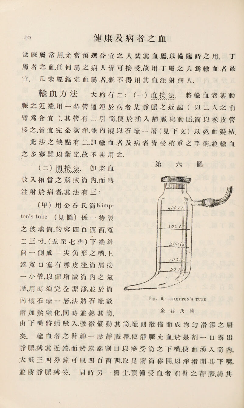 法旣屬常用•尤當預選合宜之人試其血屬.以備臨時之用.丁 屬荠之血•任何屬之病人皆可接受.故用丁屬之人爲輸血者最 宜.凡未經鑑定血屬者•槪不得用其血注射病人. 輸血方法 大約有二：（一）直接法.將輸血者某動 脈之近端，用一特管通連於病若某靜脈之近端（以二人之前 臂爲合宜）•其管有二引筒•便於插入靜脈與動脈.筒以橡皮管 接之•皆宜完全潔淨•並內襯以石蠟一層（見下文）以免血凝結, 此法之缺點有二•卽輸血者及病者皆受稍重之手術.並輸血 之多寡難以斷定，故不甚用之. (二）間接法，卽將血 放入相當之瓶或筒內.而轉 注射於病者•其法有三： (甲）用金吞氏筒 tcm’s tube (見圖）係一特製 之玻璃筒〃約容四百西西.寬 二三寸•（五至七糖）下端斜 向一側成一尖角形之嘴.上 端寬口塞有橡皮桂.筒肩接 一小管•以備增減筒內之氣 壓.用時須完全潔淨.並於筒 內襯石嫌一層.法將石蠘數 雨加熱融化•同時並熱其筒， f #氏厨 由下嘴將蠟吸入•微微擺動其筒•蠟則散佈而成均勻滑澤之層 矣.輸血者之臂縛一壓靜脈帶•使靜脈充血.於是割一 □露出 靜脈縛其近端•而於遠端割口以接受筒之下嘴•使血湧入筒內. 大抵三四分鐘可取四百西西•取足將筒移亂以淨指閉其下嘴, 並將靜脈縛妥•同時另一醫士•預備受血者前臂之靜脈.縛其