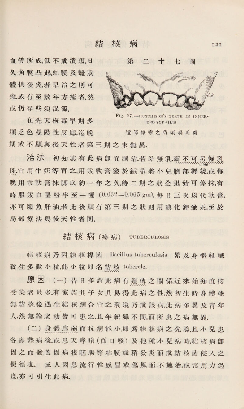 結核病 血管所成.但不成潰瘍.日 久角膜凸起.虹膜及蛲狀 體俱發炎，若早治之則可 瘉•或有至數年方瘉者.然 或仍存些須混濁. 第二十七圖 在先天梅毒早期多 顯乏色曼陽性反應.迄晚 遺瞎梅毒之葫頃森氏齒 期或不亂與後天性者第三期之末無異. 治法初知其有此病卽宜調治4若母無乳.斷不可另僱乳 ■、〜、、、、〜〜〜〜〜〜〜〜〜〜w 壤•宜用牛奶等育之•用汞軟膏塗於絨帶將小兒臍部纒^或每 晚用汞軟膏抹脚底約一年之久.待二期之狀全退始可停抹.有 時服汞白堊粉半至一喱（0.032—0.065 gm\每日三次以代軟膏. 亦可服魚肝油.若此後顯有第三期之狀則用碘化鉀兼汞.至於 局部療法與後天性者同. 結核病乃因結核桿菌Bacillus tuberculosis累及身體組織 致生多數小粒.此小粒卽名結核 tubercle. 原因（一）昔日多謂此病有遺傅之關係.近來始知直接 w〜〜〜〜〜〜〜 受染者最多•有家族其子女具易得此病之性.然初生時身體並 無結核，後遇生結核病合宜之環境乃成該病.此病多累及靑年 人•然無論老幼皆可患之•且年紀雖不同.而所患之病無異. (二）身體虛弱而抗病能小•卽爲結核病之先導.且小兒患 各瘆熟病後•或患天哮!搶（百日咳）及他種小兒病時.結核病卽 因之而發。蓋因病後咽腸等粘膜或稍發炎而成結核菌侵入之 便徑也.成人因患流行性感冒或傷風而不施治.或常用力過 度•亦可引生此病.