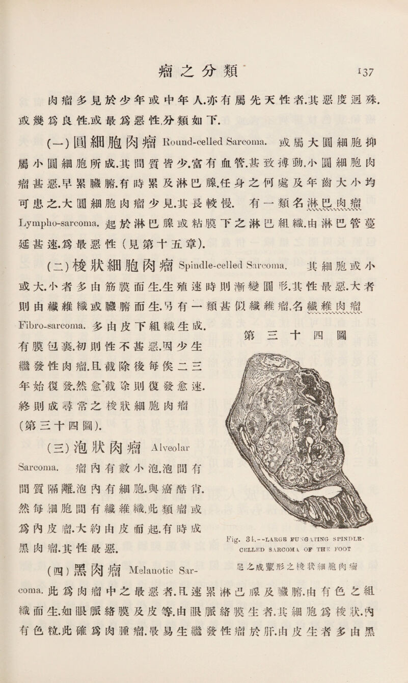 肉瘤多見於少年或中年人.亦有屬先天性者.其惡度迥殊. 或幾爲良性，或最爲惡性，分類如下. (一）圓細胞肉瘤Round-celled Sarcoma.或屬大圓細胞抑 屬小圓細胞所成.其間質皆少.富有血管•甚致搏動，小圓細胞肉 瘤甚惡.早累臟腑.有時累及淋巴腺.任身之何處及年齒大小均 可患之.大圓細胞肉瘤少見.其長較慢.有一類名 Lyrnplio-sarcoma.起於淋巴腺或粘膜下之淋巴組織•由淋巴管蔓 延甚速.爲最惡性（見第十五章). (二）梭狀細脸肉瘤Spindle-celled Sarcoma.其細胞或小 或大.小者多由筋膜而生.生殖速時則漸變圓形.其性最惡•大者 則由纖維織或贜腑而生.另有一類甚似纖維瘤名繊雜肉瘤 Fibro-sarcoma. 多由皮下組織生成. 有膜包裹.初則性不甚惡.因少生 繼發性肉瘤.且截除後毎俟二三 年始復發.然愈’截徐則復發愈速. 終則成尋常之梭狀細胞肉瘤 (第三十四圖）. (三）泡狀肉瘤 Alveolar Sarcoma. 瘤內有數小泡.泡間有 間質隔亂泡內有細胞.與癌酷肖. 然毎钿胞間有纖維織.此類瘤或 爲內皮廇•大約由皮而起.有時成 黑肉廇.其性最惡. 第三十四圖 Fig. 3t.--L4RGB FUNGvnisrG SPINDLE- CELLED S.VRCOMl OF THS FOOT (四）黑肉瘤Melanotic Sar- 足之成輩形之祕状細胞肉瘤 coma.此爲囱廇中之最惡者.氐速累淋巴腺及I藏腑.由有色之組 織而生.如眼脈絡膜及皮等.由眼脈絡膜生者/其細胞爲梭狀.内 有色粒•此確爲肉腫瘤.騷易生繼發性瘤於肝.由皮生者多由黑