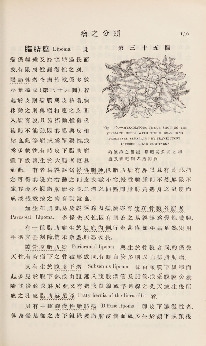脂目方廇 Lipoma. 此 瘤係繊維及蜂窩織過長而 成.有限局性彌漫性之別. 限局性者全瘤皆軟.係多數 小葉織成（第三十六圖）•若 起於皮則瘤膜與皮粘着.倘 移動之則與瘤相連之皮凹 人瘤有膜.且易搖動.惟發炎 後則不能動.因其膜與皮相 粘也.此等瘤或爲單獨性•或 爲多數性，有時皮下脂肪瘤 垂下成蒂.生於大腿者更易 如此.有者易誤認爲慢性膿腫.伹脂肪瘤有界限且有葉形.捫 、、〜〜、〜〜〜〜〜〜、〜〜〜 之可得其邊，左右動之則皮成數小鼠慢性膿腫則不然.界限不 定，其邊不似脂肪瘤分葉•二者之同點4卽脂肪質遇身之温度而 成液體《故按之均有動波也， 如生在肌間.易於誤認爲肉瘤，然亦有生在骨膜外面者 JParosteal Lipoma. 多係先天性.因有肌蓋之易誤認爲慢性膿腫, 有一種脂肪瘤生於足底內側.行走甚疼如平扁足然.須用 手術完全割除,倘未除盡•則恐復長， 髗骨膜脂肪瘤Pericranial lipoma.與生於骨膜者同.約係先 天性•有時瘤下之骨被壓成凹•有時血管多則成血痣脂肪瘤， 又有生於腹膜下者Sabserous lipoma.係由腹膜下組織而 起•多見於腹下部•或由腹延入腹股溝管及股管.或峯腹膜旁囊 隨其後致成赫尼亞，又有過腹白線或半月線之先天或生後所 成之孔成脂肪赫尼亞Fatty hernia of the linea alba者. 另有一種_漫性脂肪瘤Diffuse lip⑽a.卽皮下涵漫性者, 係身體某部之皮下組織被脂肪浸潤而成.多生於頦下或頸後 第三十五圖 Fig. 35. — MYXOMATOUS TISSUE SHOWING THE STELLATE CELLS WITH THEIR BRANCHING PROCESSES SEPARATED BY TRAKSLUCRNT INTERCELLULAR SUBSTANCE 粘液瘤之組織指明其多角之細 胞及細胞間之透明質