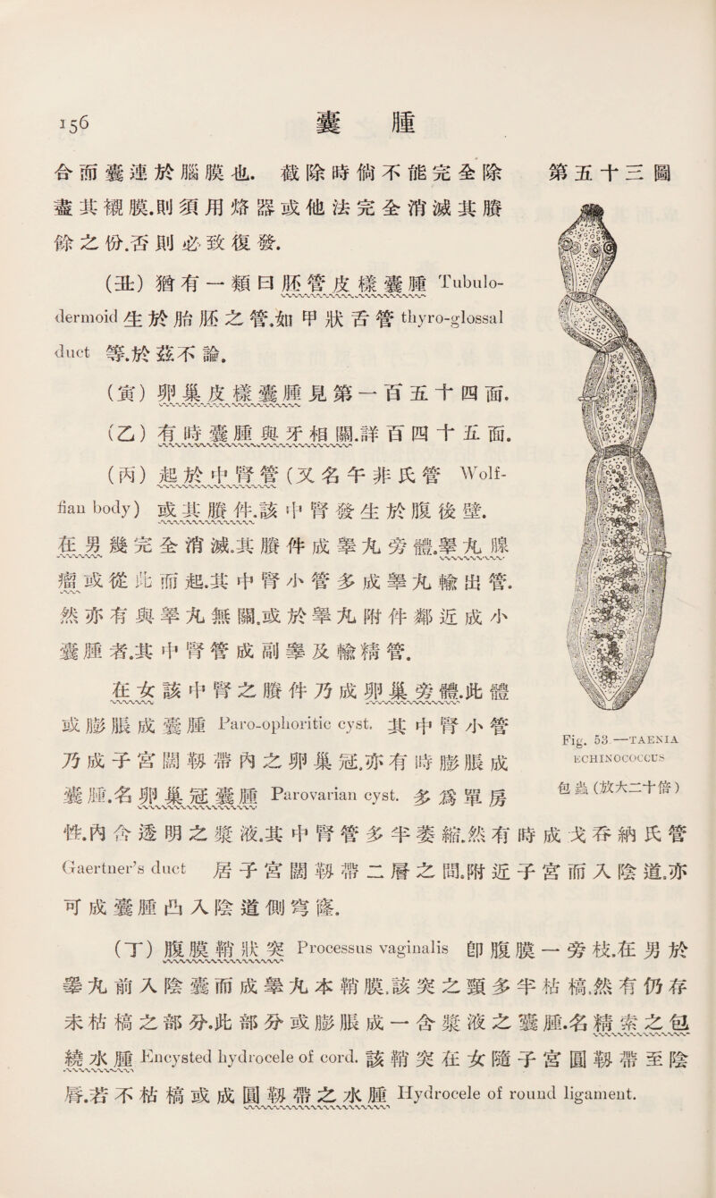合而囊連於腦膜也.截除時倘不能完全除 盡其襯膜.則須用烙器或他法完全消滅其賸 餘之份.否則必致復發. (丑）猶有一類曰胚管皮樣囊腫Tubulo- dermoid生於胎胚之管•如甲狀舌管thyro-glossal duct等，於茲不論， (寅）卵巢皮樣囊腫見第一百五十四面. 、〜〜〜〜〜*wv〜-c〜〜〜〜■wv〜〜〜W (乙）有時囊腫與牙相關.詳百四十五面8 W〜〜*C〜\IWN-WVV1W\1w〜〜〜〜〜〜〜〜〜〜〜〜 (丙）起於中腎管（又名午非氏管Wolf- 〜〜〜〜〜〜〜〜〜〜〜〜〜〜〜〜〜〜〜 fian body)或其賸件.該中腎發生於腹後壁. 在男幾完全消滅。其賸件成睾九旁體,睪九腺 ■-〜〜〜〜〜〜〜 WV、、〜*VVW 瘤或從&而起，其中腎小管多成睾九輸出管. W〜〜、 然亦有與翠九無亂或於擧九附件鄰近成小 囊腫者4其中腎管成副睾及輸精管. 在女該中腎之賸件乃成卵巢旁體.此體 或膨脹成囊腫Paro-ophoritic cyst。其中腎小管 乃成子宫闊靱帶內之卵巢冠,亦有時膨脹成 囊滕•名卵巢冠囊腫Parovarian cyst.多爲單房 第五十三圖 Fig. 53. —TAENIA ECHINOCOCCUS 包蟲（放大二十倍) 性•內含透明之漿液.其中腎管多半萎縮.然有時成戈呑納氏管 Gaertner?s duct 居子宮闊靱帶二層之間8附近子宮而入陰道5亦 可成囊腫凸入陰道侧穹窿. (丁）腹膜鞘狀突Processus vaginalis卽腹膜一旁枝，在男於 擧九前入陰囊而成睾九本鞘膜，該突之頸多半枯槁，然有仍存 未枯槁之部分•此部分或膨脹成一含漿液之囊雇•名精索之包 繞水腫Encysted hydrocele of cord.該稱突在女隨子宫圓靱帶至陰 脣.若不枯槁或成圓靱帶之水腫Hydrocele of round ligament.