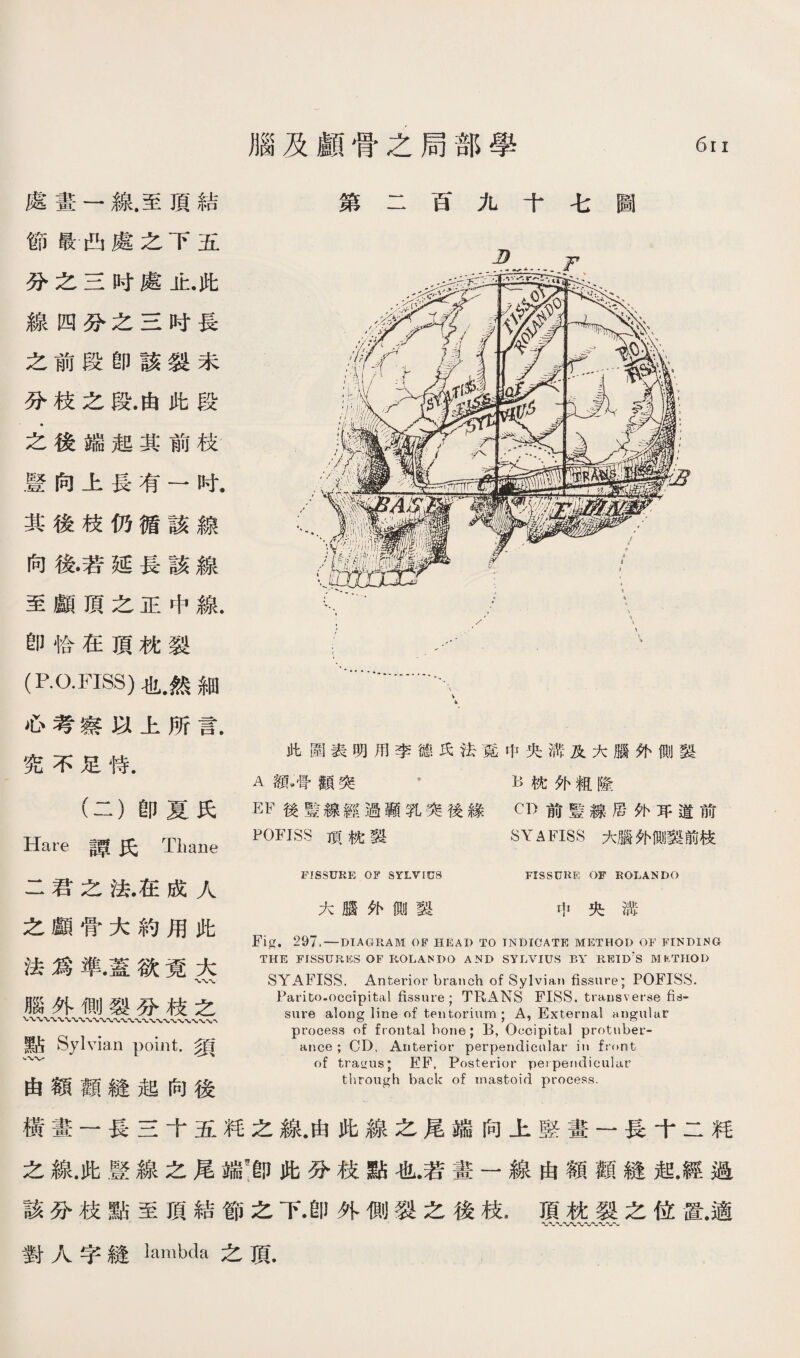 腦及顧骨之局部學 6r I 處畫一線.至煩結 節最西處之下五 巧之S时處止.此 線四巧之S时長 之前段卽該裂未 苏枝之段.由此段 占:後端趙其前枚 暨向上長有一时. 其後枝仍循該線 向後若延長該線 至顧頂之正中線. 卽恰在頂枕裂 (RO.F扮S)也然細 必考繁巧上所言. 宪不足恃. (二）卽夏氏 Hare 譚氏 Thane 第二百九十毛圖 此圃表明用李徳巧法奠中央滞及大腦外側裂 A額婿觀突 ’ K恍化粗隆 EF後藍線經過蕭乳突後緣 CD前藍線居化巧道前 POFISS -項槐藝 SYAFISS大腦化測藝前技 FISSURE 0¥ SrLViUS FISSUUE OF ROLANDO 大赔外側裂 中央滞 Fig. 29了‘一DIAGRAM OF HEAD TO INDICATE METHOD OF FINDING THE FISSURES OF ROLANDO AND SYLVIUS BY R朽ID，S MKTIIOD SYAFISS. Anterior branch of Sylvian fissure; POFISS. Parito-occipital fissure ; TRANS FISS. transverse fis- sure along line of tentorium ; A, External angular process of frontal hone ; B, Occipital protuber¬ ance ;CD, Anterior perpendicular in front of trairus; EP. Posterior pet pendicular through back of mastoid process. 橫畫一長S十五巧之線.由此線之尾端向上監畫一長千二釋 之線.此聲線之尾端!卽此發枝點也.若畫一線由額觀縫起.經避 該汾枝點至頂結節之下.卽外側裂之後枝，煩枕裂之位置.適 對人字縫lambda之頂. 二君之淑在成人 之願骨大約用此 法爲準.蓋欲竟大 腦外側裂分枝么 點 Sylvian point.須 、、、• 由額觀縫起向後