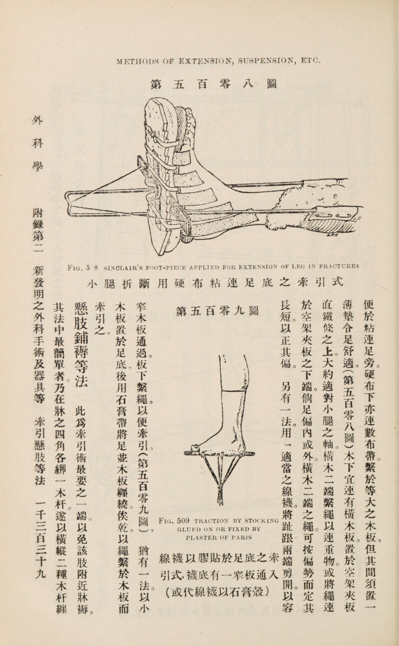 第五百零九圖 仪。 正 其； 偏。 另 有 法。 用 適 當 之 線 礫。 將 Fia. 509 TRACTION BY STOrivlNG GLUK】）ON OR FIXKD BY 抽t PLASTER OF PARIS 跟 兩 線穗ia膠貼於足底之牽^ 引式，礫底有一窄板通入 (或代線磯KJI石膏殼） 容 Fia. 5 8 SINCLAIR’S FOOT-PIECE APPLIED FOK KXTKNSION oK LEG IN FRACTURES 小腿折斷用硬布結速足底之牽引式 MET打()I)S OF EXTENSION, SUSPENSION, ETC. 第五百零八圖 外 便於粘速足旁。硬布下亦連數布帶。繫於等大么木板，但其間巧® 一 薄垫令足舒亂(第五巧零八圖)木下宜速有橫木私置於空架夾板 直鐵條之心大約適對小腿之^橫木二端繫繩3連重^或將繩連 於空架夾板之下^倘足偏內或橫木二端之篆可按偏勢而定其 窄木板通亂板下繫艦喊便牽？1^(第五育零九圆)。猶有一法巧小 木板攪於足^私後用石膏帶將足张木板總si俟乾喊繩繫於木板而 牽引么。 。 懸肢鋪禱等法此爲牽引術最耍之一揣。巧免該肢附近牀觀 其法中最簡單者。巧在牀之四巧各挪一木杆。遂巧橫縱二穂木巧鱗 新發明么外科手術及器具等牽引懸肢等法一千白一.二千九