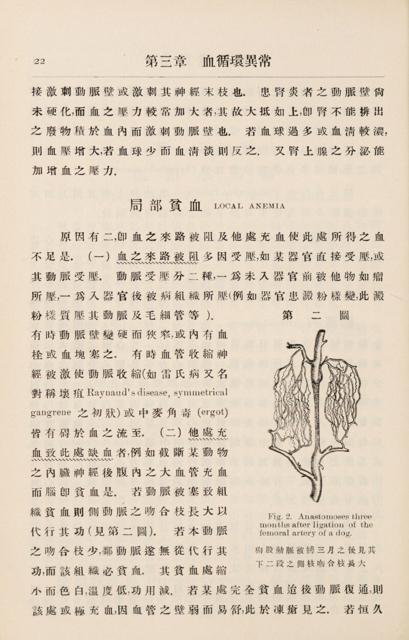 接激刺動脈壁或激刺其神經末枝也.患腎炎者之動脈壁尙 未硬化，而血之壓力較常加大者，其故大抵如上，卽腎不能排出 之廢物積於血內而激刺動脈壁也.若血球過多或血淸較濃， 則血壓增大，若血球少而血淸淡則反之，又腎上腺之分泌能 加增血之壓力. 局部貧血local ANEMIA 原因有二，卽血之來路被阻及他處充血使此處所得之血 不足是.（一）血之來路被阻多因受歷，如某器官直接受壓，或 其動脈受壓，動脈受壓分二種，一爲未入器官前被他物如瘤 所壓，一爲入器官後被病組織所壓(例如器官患澱粉樣變，此澱 粉樣質壓其動脈及毛細管等X 有時動脈壁變硬而狹窄，或內有血 栓或血塊塞之*有時血管收縮神 經被激使動脈收縮(如雷氏病又名 對稱壤疽 Rayuaud’s disease，symmetrical gaugreue之初狀）或中麥角毒（ergot) 皆有碍於血之流至，（二）他處充 血致此處缺血者，例如截斷某動物 第 圖 之內臟神經後腹內之大血管充血 而腦卽貧血是.若動脈被塞致組 織貧血則側動脈之吻合枝長大以 代行其功（見第二圖）.若本動脈 之吻合枝少，鄰動脈遂無從代行其 功，而該組織必貧血0其貧血處縮 小而色白，温度低，功用減.若某處完全貧血迨後動脈復通，則 該處或極充血，因血管之壁弱而易舒，此於凍瘡見之.若恒久 Fig. 2. Anastomoses three months after ligation of the femoral artery of a dog. 狗股動脈被縛三月之後見其 下二段之側枝吻合枝長大