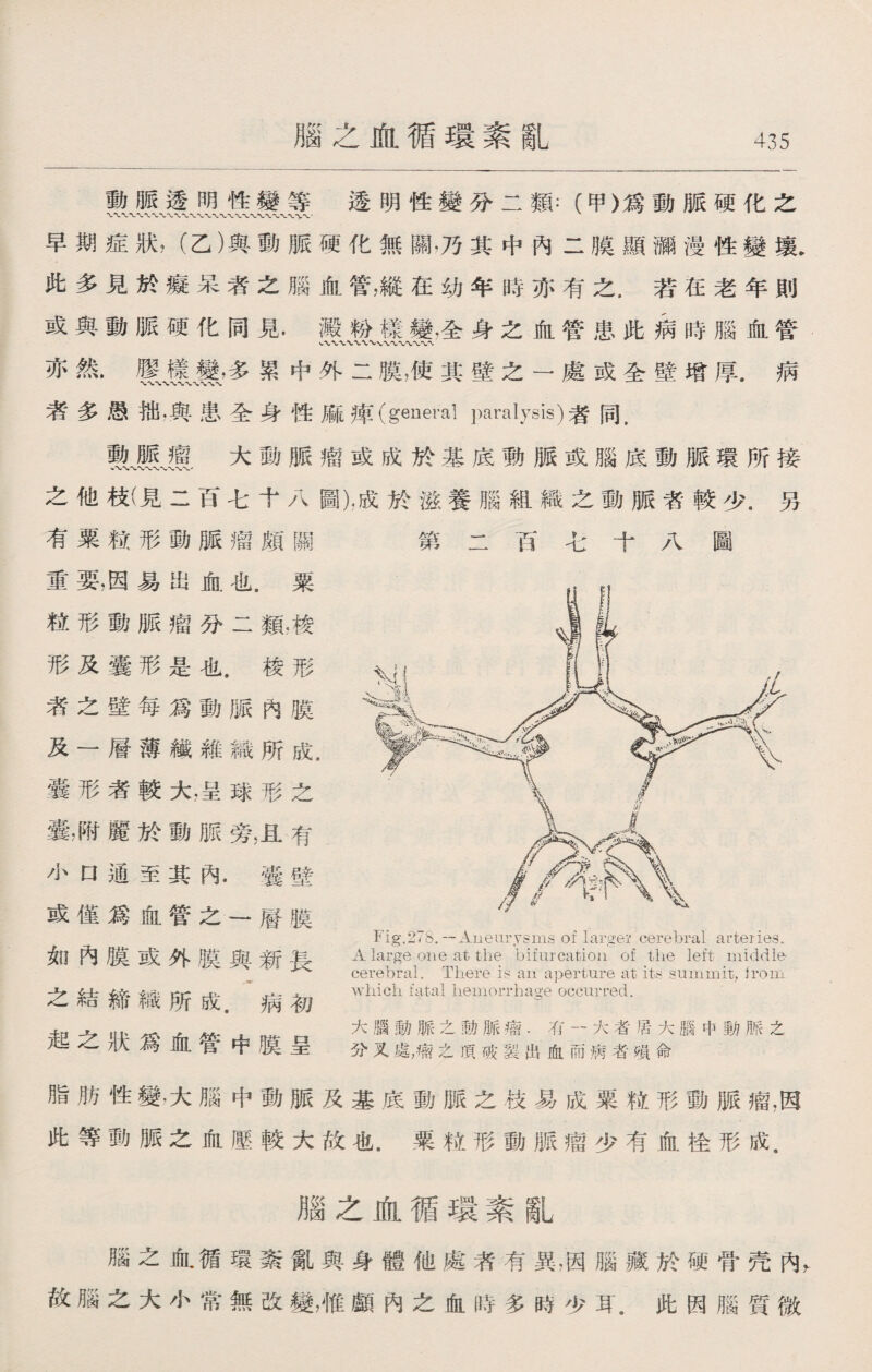 腦之血循環素亂 動脈透明性變等透明性變分二類：（甲〉爲動脈硬化之 早期症狀，（乙）與動脈硬化無關，乃其中內二膜顯漏漫性變壤. 此多見於癡呆者之腦血管，縱在幼年時亦有之.若在老年則 或與動脈硬化同見.澱粉樣變，全身之血管患此病時腦血管 亦然.祖多累中外二膜，使其壁之一處或全壁增厚.病 者多愚拙.與患全身性麻痺（general paralysis)者同. lill,大動脈瘤或成於基底動脈或腦底動脈環所接 之他枝(見二百七十八圖)•成於滋養腦組織之動脈者較少.另 有粟粒形動脈瘤頗關 第二百七十八圖 重要，因易出血也，粟 粒形動脈瘤分二類，梭 形及囊形是也.梭形 者之壁每爲動脈內膜 及一層薄纖維織所成 囊形者較大，呈球形之 囊，附麗於動脈旁，且有 小口通至其內.囊壁 或僅爲血管之一層膜 如內膜或外膜與新長 之結締織所成.病初 起之狀爲血管中膜呈 脂肪性變，大腦中動脈及基底動脈之枝易成粟粒形動脈瘤，因 此等動脈之血壓較大故也.粟粒形動脈瘤少有血栓形成. 腦之血循璜素亂 腦之ifil循環紊亂與身體他處者有異，因腦藏於硬骨壳內， 故腦之大小常無改變，惟顱內之血時多時少耳.此因腦質微 which fatal hemorrhage occurred. 大腦動脈之:勒脈瘤.耵一大者居大腦中動脈之 分叉處，瘤之頂破裂出血而病者璜命
