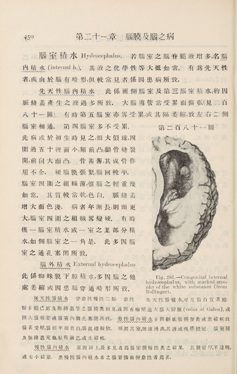 45° 第二十一章腦膜及腦之病 - *■ - i * L » , f - 腦室積水Hydroceplmhis.若腦室之腦脊髓液.增多，名腦 內積水（interim】 li.).其液之化學性等大抵如常.有爲先天性 者，或由於腦有畸形，但較常見者係因患病所致. 先天性腦內積水 此係兩惻腦室及第三腦室積水，約因 脈絡叢產生之液過多所致.大腦導管常受累而擴張(見二ft 八十一圖).有時第五腦室亦晷受累，或其隔萎縮，致左右二側 腦室相通.第四腦室多不受累. 第二百八十一圖 此病或於初生時見之，頭大似球，四 圍過五十糎面小，額前凸，顱骨縫裂 開，前囟大而凸.骨甚薄，其成骨作 用不全•硬腦膜張緊，腦回較平. 腦室四圍之組織薄，惟腦之輕重幾 如常.其質較常軟，色白.脈絡叢 增大而色淺.病者年漸長，則頭更 大，腦室四圍之組織畧變硬.有時 僅一腦室積水或一室之某部分積 水，如侧腦室之一角是.此多因腦 室之通孔塞閉所致. 腦外積水 External hydrocephalus 此係蝴蛛膜下腔積水，多因腦之他 Fig. 281.—Congenital internal -- - - hyclrocephalus, with marked atro- 處萎縮或因患腦穿通畸形所致 of 、Yhite substance (from Bollinger). 氮及麵1$分急性慢性二類：急性 先天性臘積水，可見膦白貫萎縮. 類多繼已累及脈絡叢等之腦膜炎而見，或因有瘤壓迫大腦大靜脈(veins of Galen),或 '因大臘導管或腦室內側孔塞閉观致.急性腦內積水多因顱底膦膜發炎或患結核.致 、〜、〜〜〜〜、、〜' •一 腦甚受壓，臘回平而色白，腦紺織較軟.切開其室，則液涌出，其液或現膠择變.滕室膜 及脈絡叢充血，砧附淋巴，或生結核. 徵lyiQil杰原因同上最多見者爲腦室膜慢性炎之結果•其膜變厚，不逶明, 或有小結節.患慢性腦內積水者之腦室擴很較急性着爲甚.