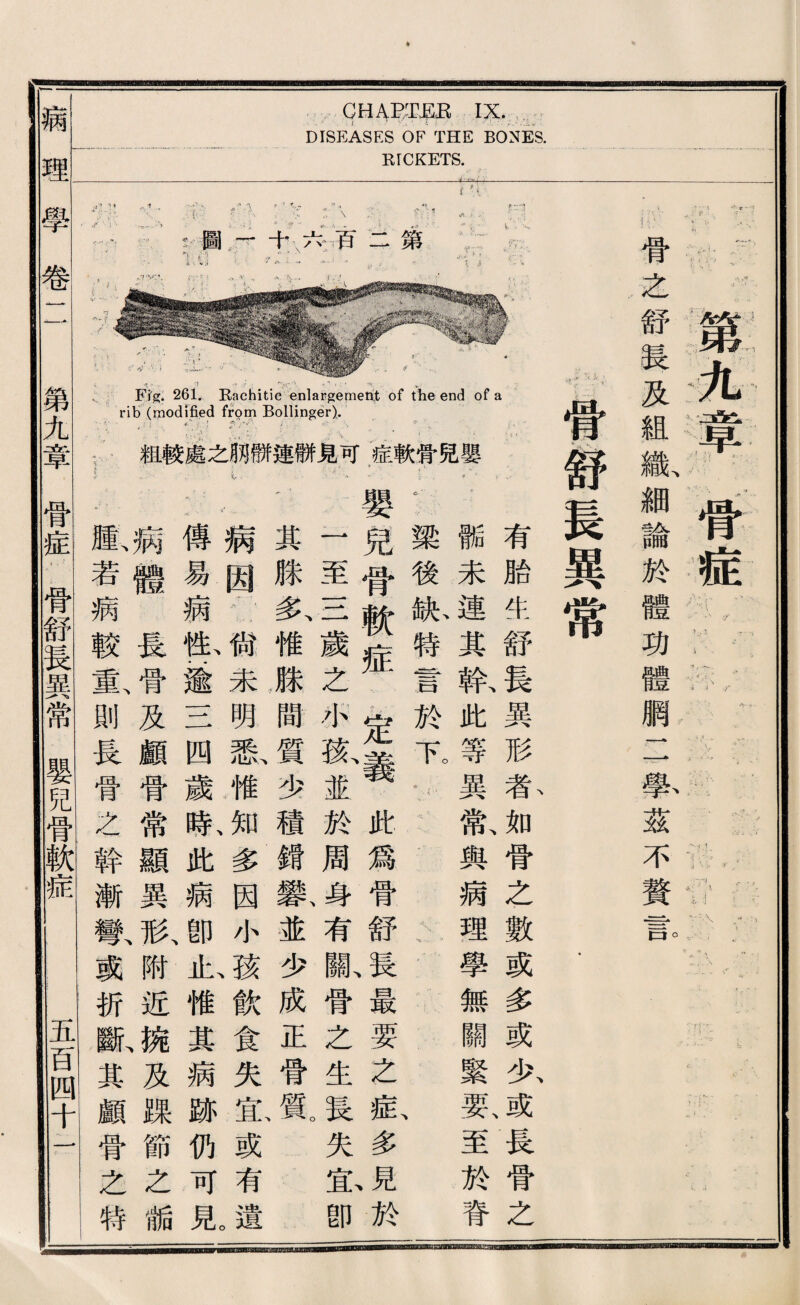 GHA；明'哗辟':r DISEASES OF THE BONES. KrCKETS. 簾九赛；；皆症 骨么舒Ig及組織細論於體巧體網二學茲不賛言 嘗：舒長異常 有腊牛：舒長異形私如骨之數或多或如或長骨之 :.號未連其歡此等異歡與病理學無關繫要、至於脊 V梁後献特言於一^，； ..、、 、 嬰兒骨軟症 '定義此爲骨舒長最要之載多^於 至一二歲之水换並於周身有齡骨么生長失忠卽 其滕多、惟嚴間質少積鑛歎並少成正骨質。 病因S .狱未明乘I惟知多因小孩飮食失宜、或有遺 傅易病歡蠢一二四歲私此病卽止、惟其病跡仍可見 病纏長骨及顧骨常顯異形附近婉及规節之妒 阪若病較塞則畏骨么幹漸攀或巧斷、其顧骨么特 禱理擧卷1 1 第九章骨症.1骨舒長異常嬰兒管軟症 五百四十~1