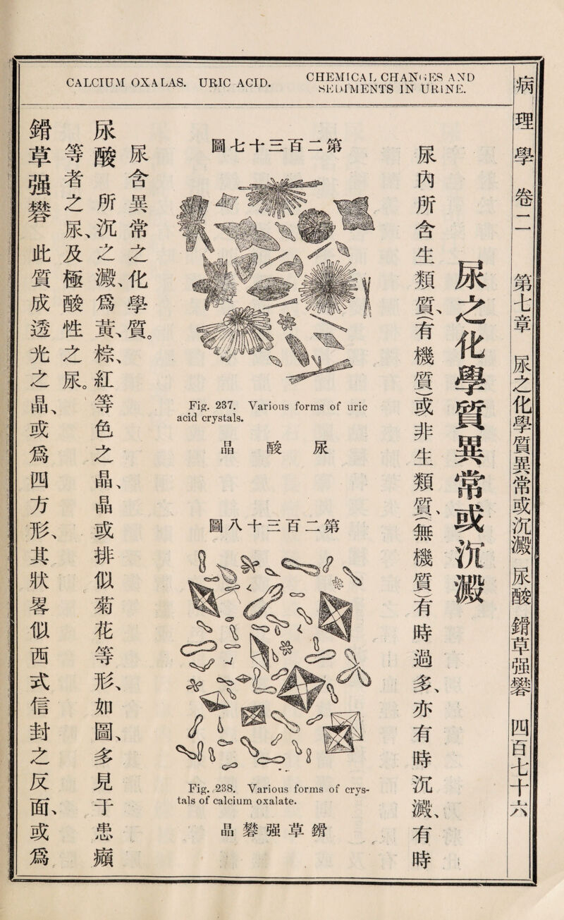 Fig. 237. Various forms of uric acid crystals. 晶 酸 尿 圖八十S百二第 Fig.,238. Various forms of crys¬ tals of calcium oxalate. 晶變强草銳 CALCIUM OX A LAS. URIC ACID. CHEMICAL C打A机脱 AND SKUIMENTS IN URINE. 病i 理學卷二 第A章尿么化學質異常或沉鑛尿酸鑛草强變四百A千六 尿之化學質異常或無微..， i . 一 < * ' 展內所含生類瞥一肴機質)或非生類鼠(無機質肴時過氧亦有時沉贩有時 尿含異常之化學質 .. 尿酸所沉、之觀爲載糕紅等色之晶、晶或排似菊花等歡如圖、多見于患類 等者之獻及極酸性之尿： . 錯草强變此質成透光之晶、或爲四方於其狀蓉似西式信封之反厮或爲