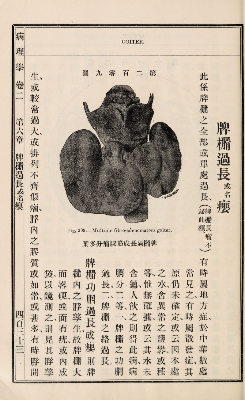 病 理 GOITER. ， 牌欄過長 或名 此係牌娜之全部或單處過忘(I餓觀、瘤不) 第 百 零 九 圖 化 哨 加觸 議過 1成 扣筋 ^腺 的霞 W巧 言 cM棠 > 生或較常過大或排列不齊似瘤脖內之膠 ^學卷二 第六章牌繼過長或名瘦 有時屬地方症於中華數處 常見玄有時屬散發私其 原仍未確忠或云因本處 之水含異常之鹽繫或權 暮^無權據或云其水未 含戴人飮之則得此病病 網分J 一暮一、牌權之功網 過忘1、一牌娜之絡過良 牌繼功鋼過長成瘦則牌 權內么脖擎生故牌欄大 而暑祗或面有张或內成 豁巧鏡測么則見其脖擎 質或如歡或甚多、有時脖間 iMir当 1^^^