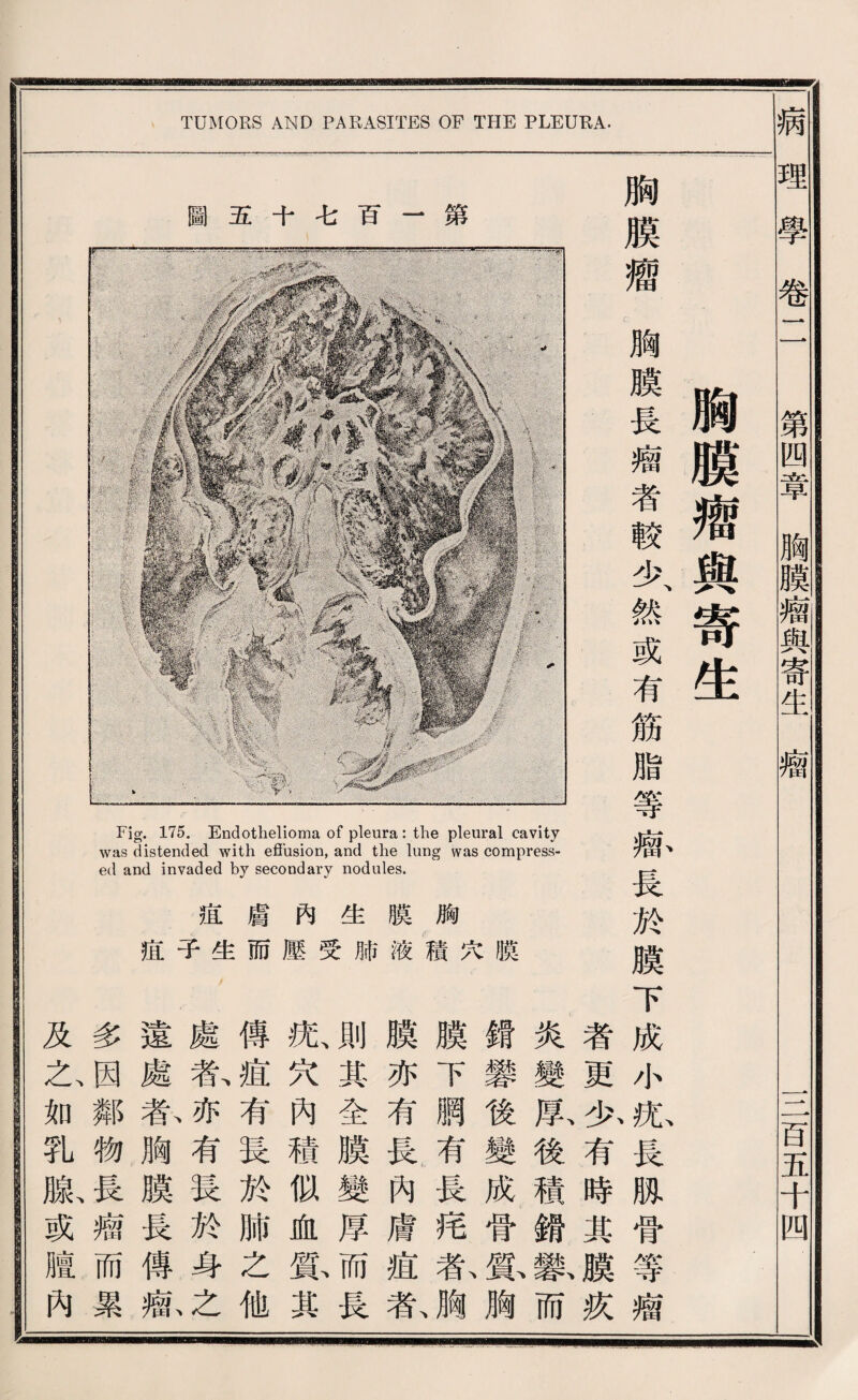 TUMORS AND PARASITES OF THE PLEURA. 病 理學卷二 第四章胸蝴牆與寄生瘤 S百五千四 胸膜總輿寄生 胸膜禮f胸膜長禱者較少、然或有筋脂等觀長於膜下成小^畏脫骨等瘤 者更少有時具膜疚 炎變雇後積銳歎而 || ^ 2苏後變成骨藤胸 fj 胸I 膜下®有長一^ 加放膜液 麟亦有長內膚痘氣 Ml n It 口。口 J||生^ 則其全膜變厚而長 j||內« 报巧內穗似藤其 III膚而 傅痕有長於肺之他 fll適^‘ .處乾亦有霞於身之 yj 趙蠢春胸膜長傳觀 多因鄰物長槪而累 及么如乳賊或贈內