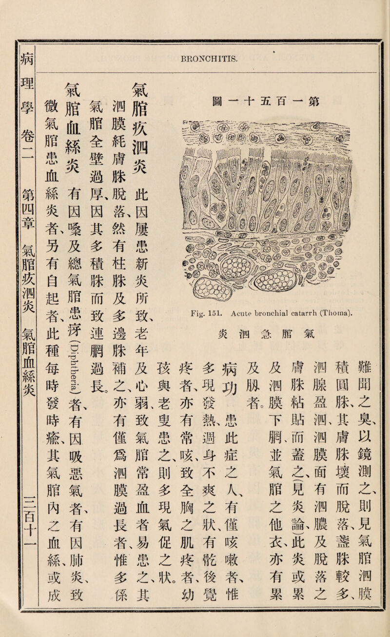 BRONCHITIS, 第 百 显 圖 i 1 氣 倍 急 涧 炎 難聞之兔凶鏡測之則見氣脂卿膜 積圓胀其膚滕.壞而脫齡盞滕較务 卿腺盈卿卿膜趙有卿濃及脫落之 膚滕粘貼而蓋之、竟炎聲此炎或累 及测膜下脈並氣贈之他衣亦有累 及胁幕 病功患此症之人、有僅咳嗽私惟 多現發說週身不爽之狀、有髓後覺 疹东亦有常麻致全胸之肌疼歡幼 孩與老叟患之、則多現氣化之獻 氣脂疚洒炎此因屢患新炎所斯老年及 >心駄致氣贈常盈化者^患己其 洒騰耗膚滕脫i斬然有柱滕及多邊滕補，一亦有健爲测膜媪畏私惟多係 氣脂全壁過属因其多積滕而致連網過良、 、 、 氣脆化絲炎有因變及總氣腊患薄(D宮tberia)春有因吸惡氣春有因肺私致 微氣腊患血綠炎春另有宫趙私此種每時發時^其氣贈內K一施縣或成 病理學卷二 第四章氣脂疚测炎氣脂血絲炎 一二百千