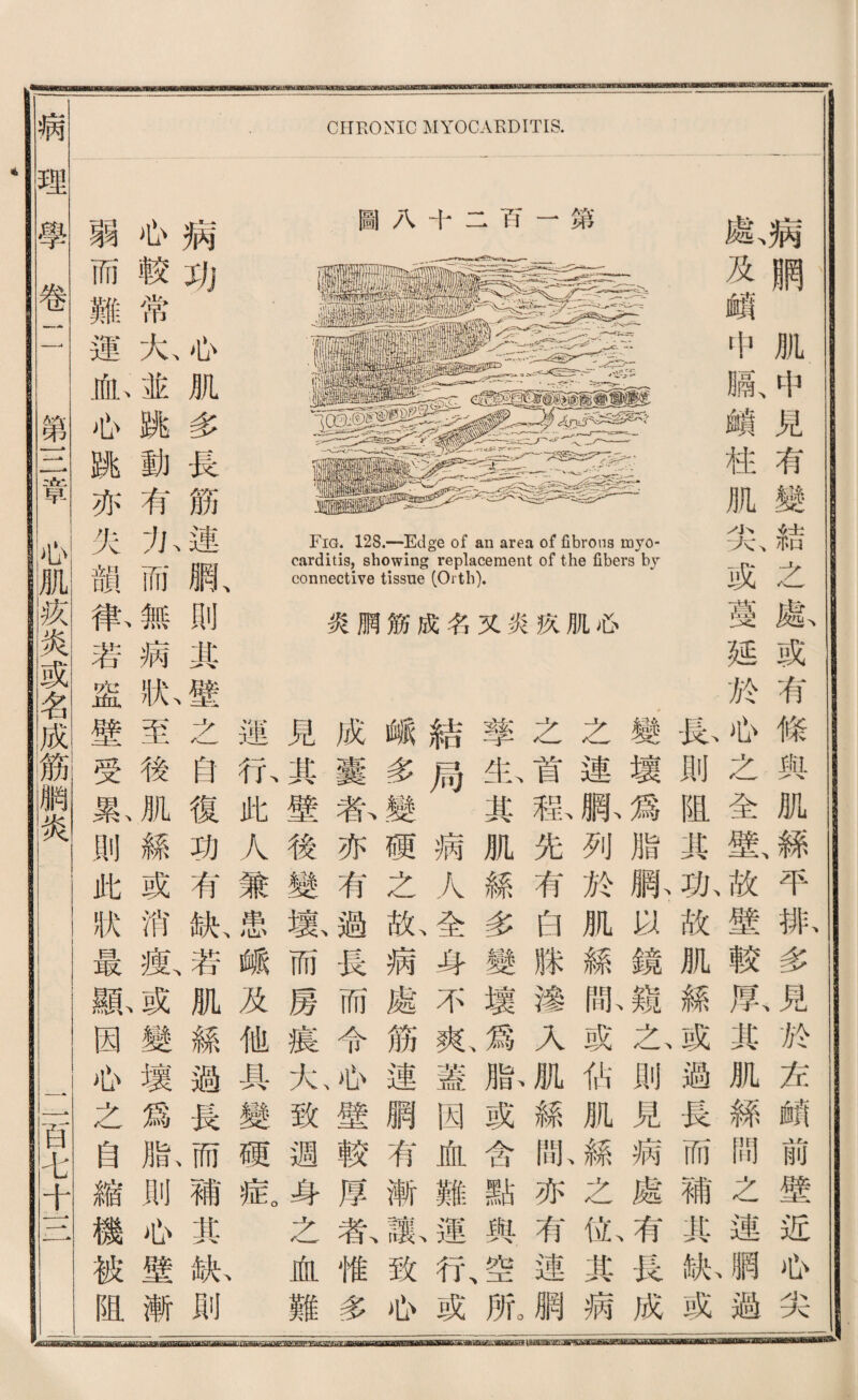 fWiliiifiWMifiTwim mwtmmaMaMaaommmmoffiii i—■ ii ■ i ummmmmwwtwa CriEONIC MYOCARDITIS. 病網肌中見有變結之獻或有條與肌絲平拂多見於左賴前壁近也尖 獻及頓中瞩、鑛稚肌尖、或蔓延於也之全鑑故壁較默其肌絲問之連鹏避 私則阻其孤故肌絲或過長而補其瓜或 變壞爲脂赋切鏡窥么則見病處有長成 之連脈列於肌絲献或化肌絲之化其病 之首私先有白滕辕入肌綠亂亦有連網 擎私其肌絲多變壞爲腺或含點與空肥 血難運行或 巧 一一 十 八 圖 己 fi U f f o o ♦ Im b 读I s ( d巧e E.s那 一 w扣 郎-g ^ 1 w G u e 扔忠 必 肌 疚 炎 义 名 成 筋 腑 炎 結局病人全身不爽蓋 峨多變硬之亂病處筋連網有漸歌致也 成囊豁亦有過長而令瓜壁較厚氣惟多 見其壁後變载而房寢九致週身之血難 運化此人兼患峨及他具變硬乾 、 病巧瓜肌多畏筋連脈则某壁之白復功有紙若肌絲過長而補其獻則 侣較常九並姚動有九而無病於至後肌絲或消敏或變壞爲臘則瓜壁漸 弱而難運，邮也跳亦失韻衝若盛壁受款則此狀最觀因侣之箇縮機被阻 理學卷 i i 第一.二窜 —一百韦十一一 I