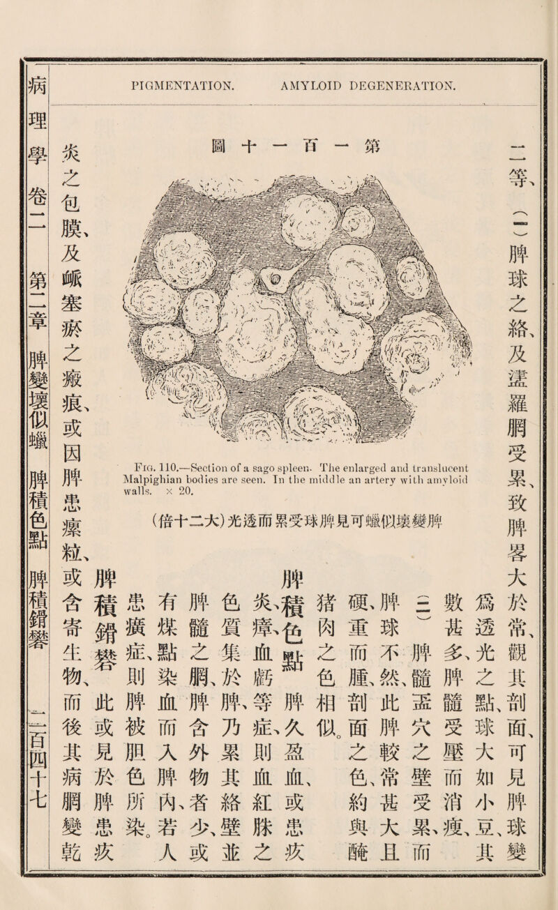 PIGMENTATION. AMYLOID DEGENERATION. 1等二)脾球之絡及證羅網受累致脾 if 1% V 9 i n n • 1 u T1 11 V. r - t I。 6 t r 巧 圖 、：A 含5 i裤V 議‘ 詞 ft G TJ h d TM 酣隊 I n2 o a K UM X •咨 邏 MW 猶 變 攘 似 臟 可 見 鹏 球 受 累 透 光 二 十 炎之包膜及峨塞齋之癒痕或因脾患攘 霉大於常觀其剖面可見脾豫變 爲透光之點、球大如小瓦其 數甚务脾髓受壓而消敏 三三膊髓壺巧之壁受藤而 脾球不然-此脾較常甚大且 胁重而腺剖面之色、約與醜 猪肉之色相似。 牌带色點脾^盈血、或患疚 乂i截血麟等私則血紅滕之 色質集於齡乃累其絡壁並 脾髓之脈膊含外物者少或 有煤點染血而入脾亂若人 患鑽私則脾被胆色所染。 牌積錯變此或見於脾患疚 齡或含寄生物、而後其病網變齡 病理學卷11 第二章脾變壞似驗脾積色點脾積鑛i齋 -豆跑十屯 HB