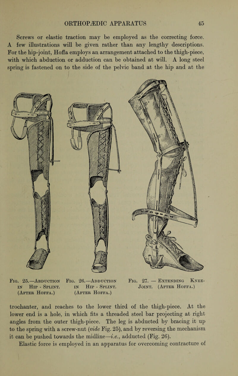 Screws or elastic traction may be employed as the correcting force. A few illustrations will be given rather than any lengthy descriptions. For the hip-joint, Hoffa employs an arrangement attached to the thigh-piece, with which abduction or adduction can be obtained at will. A long steel spring is fastened on to the side of the pelvic band at the hip and at the Fig. 25.—Abduction Fig. 26.—Adduction Fig. 27. — Extending Knee- in Hip - Splint. in Hip - Splint. Joint. (After Hoffa.) (After Hoffa.) (After Hoffa.) trochanter, and reaches to the lower third of the thigh-piece. At the lower end is a hole, in which fits a threaded steel bar projecting at right angles from the outer thigh-piece. The leg is abducted by bracing it up to the spring with a screw-nut (vide Fig. 25), and by reversing the mechanism it can be pushed towards the midline—i.e., adducted (Fig. 26). Elastic force is employed in an apparatus for overcoming contracture of